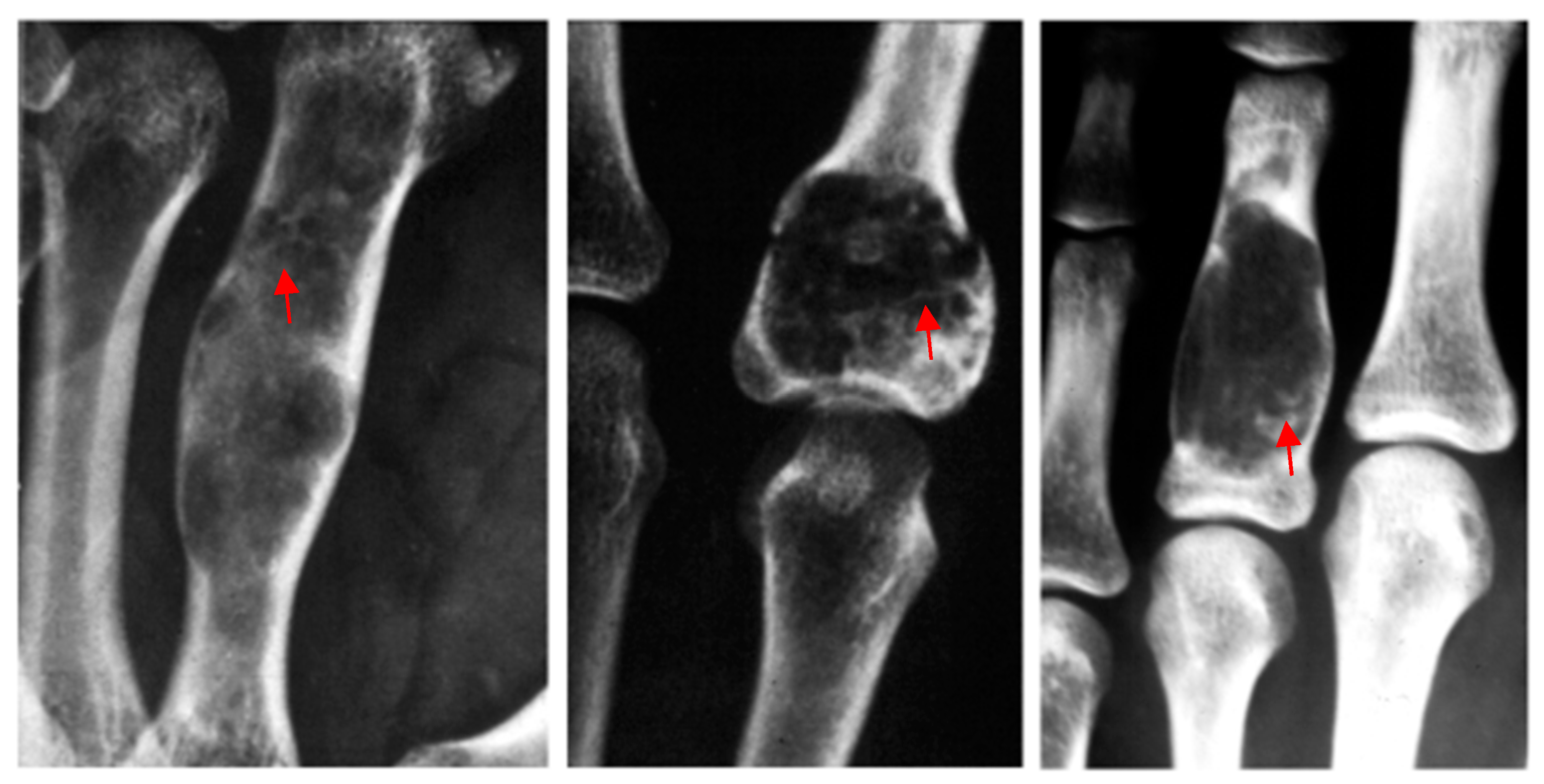 Diseases 13 00084 g001