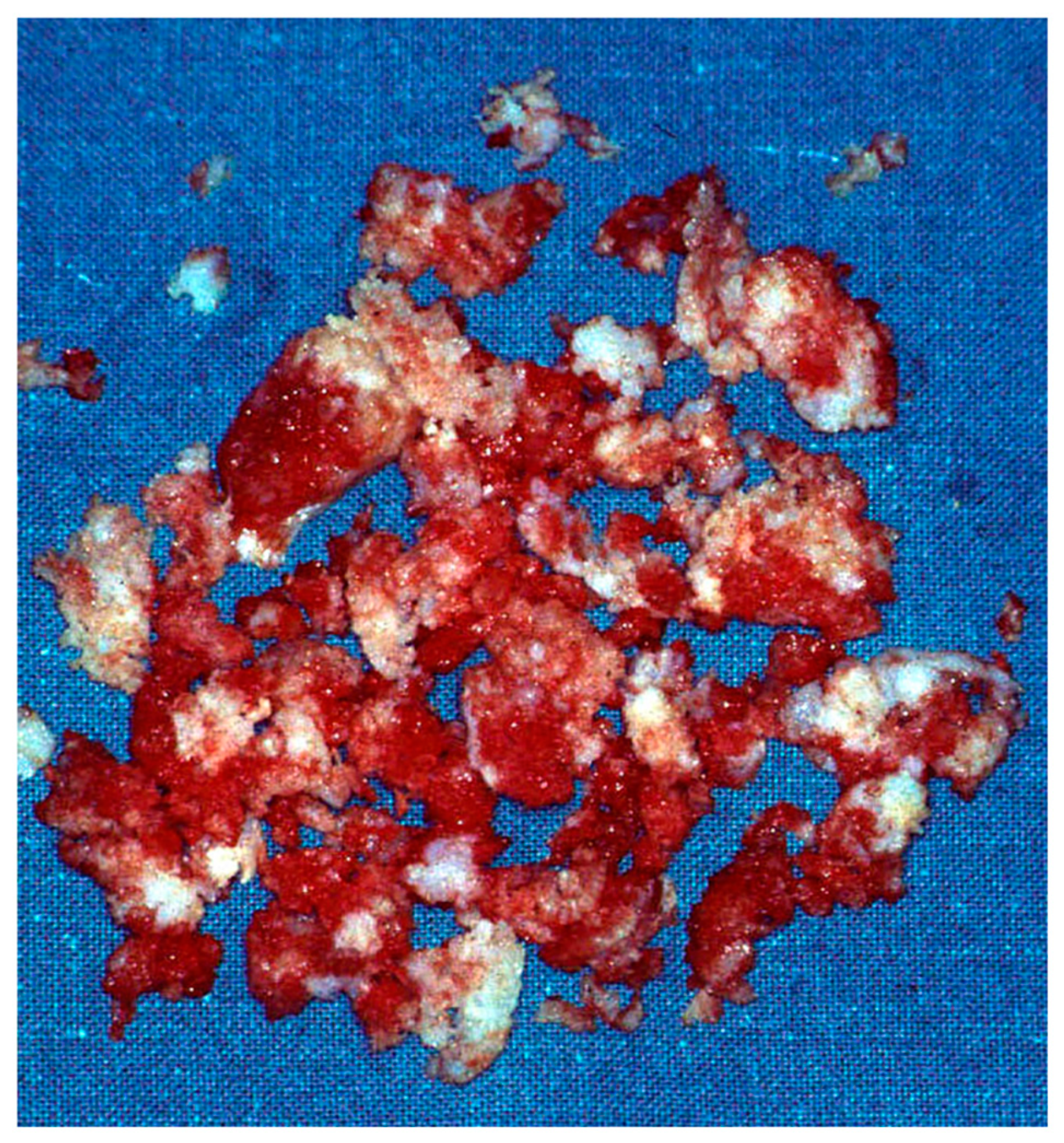 Diseases 13 00084 g003