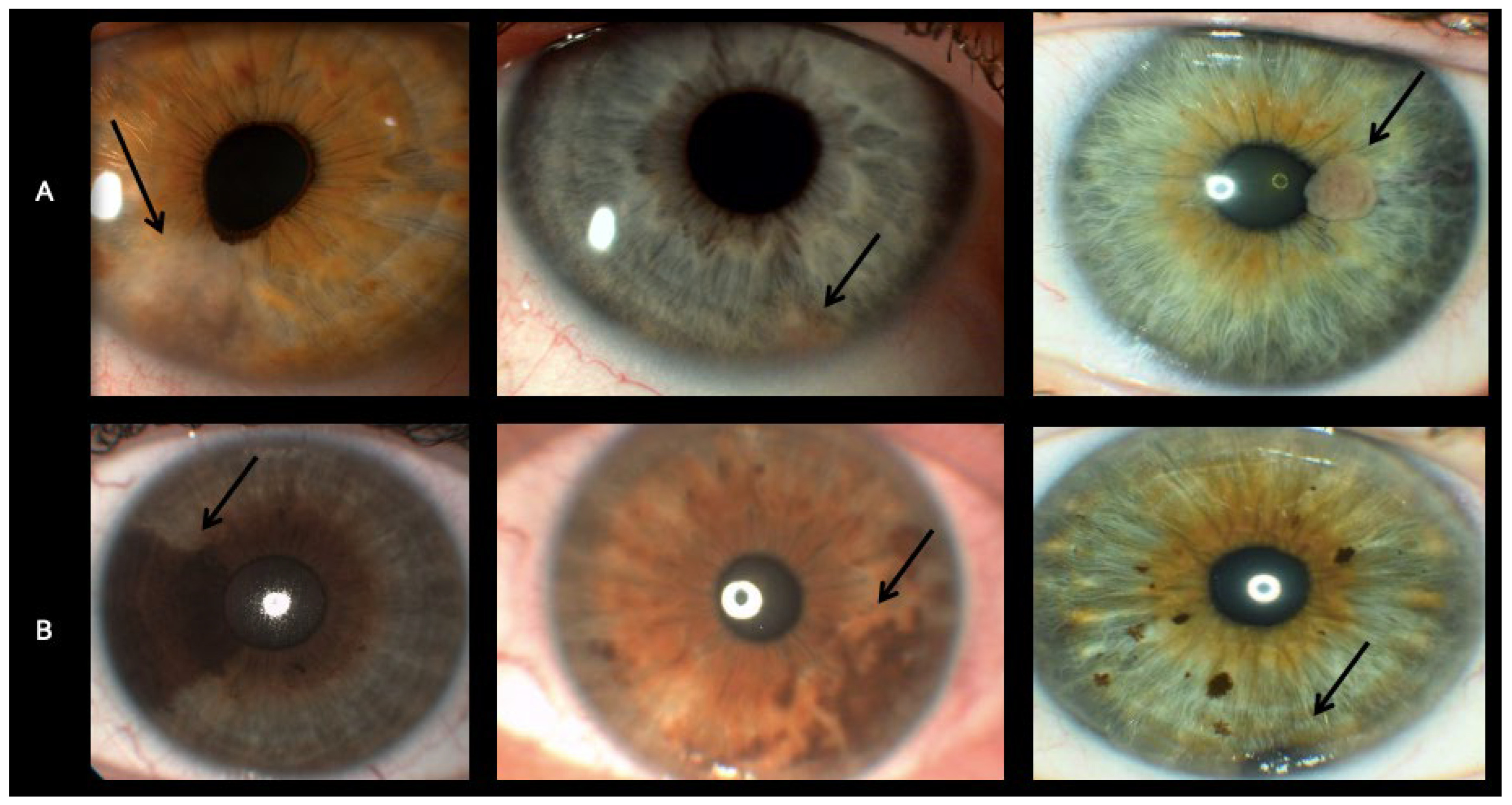 Diseases 13 00099 g001