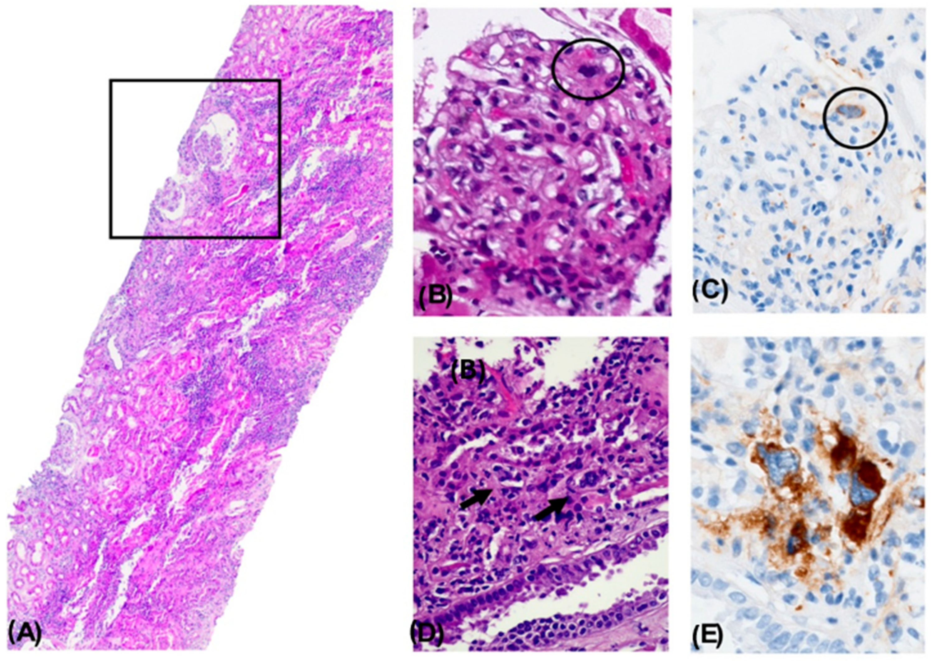 Diseases 13 00162 g001
