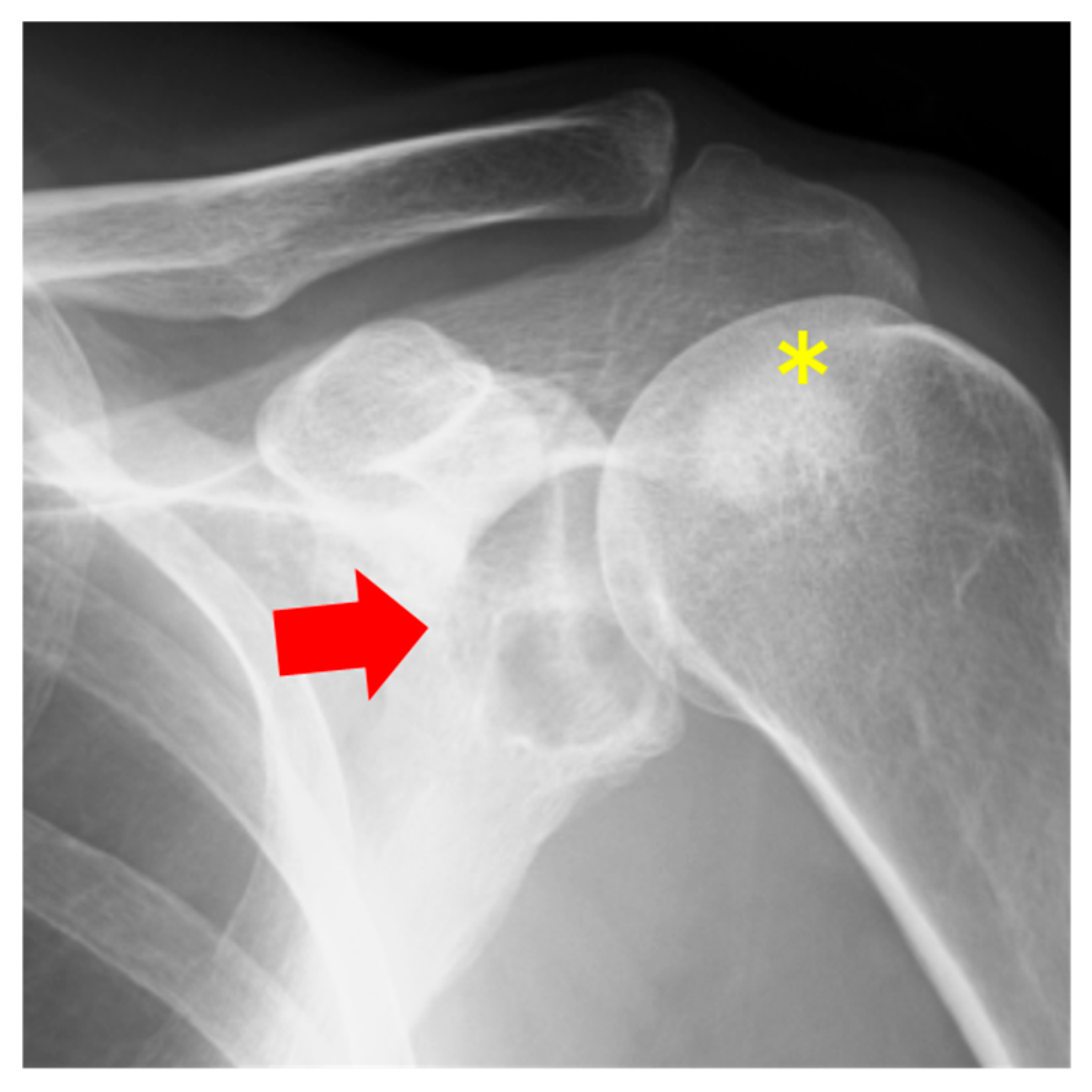 Diseases 13 00170 g004