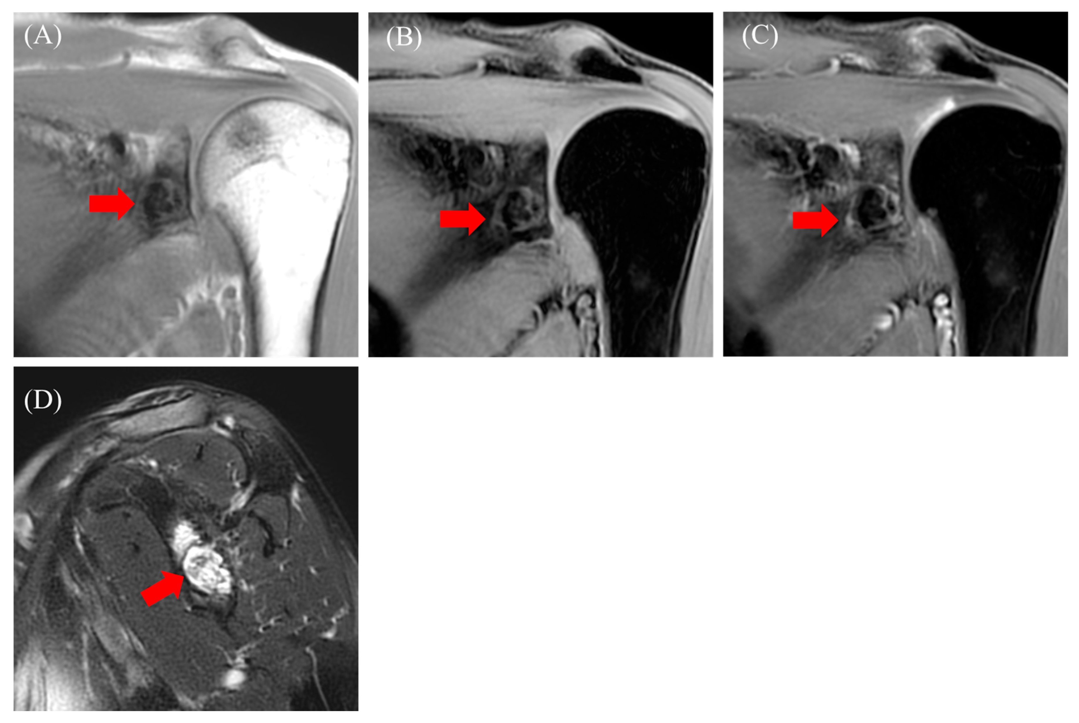 Diseases 13 00170 g005