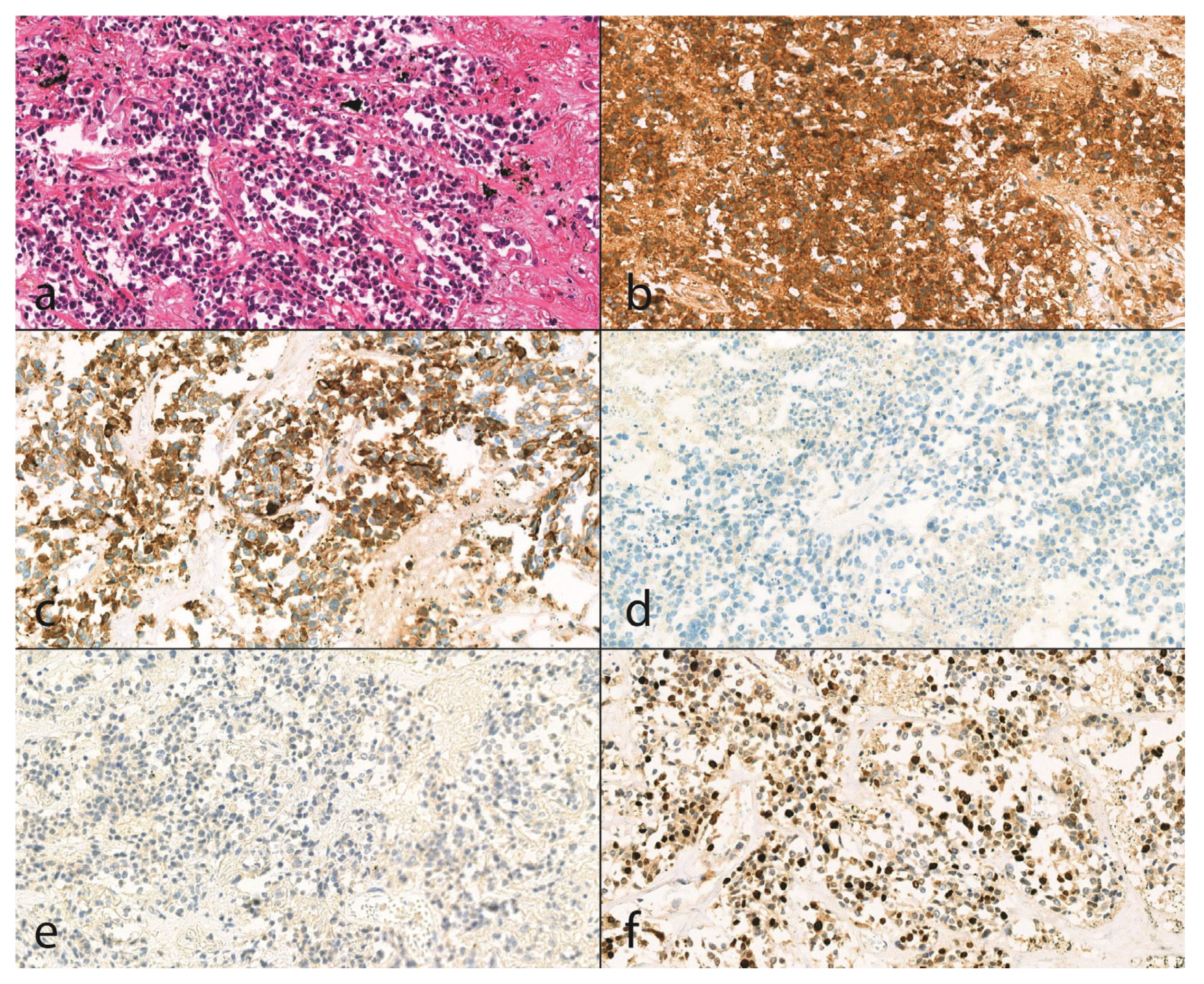 Diseases 13 00174 g001