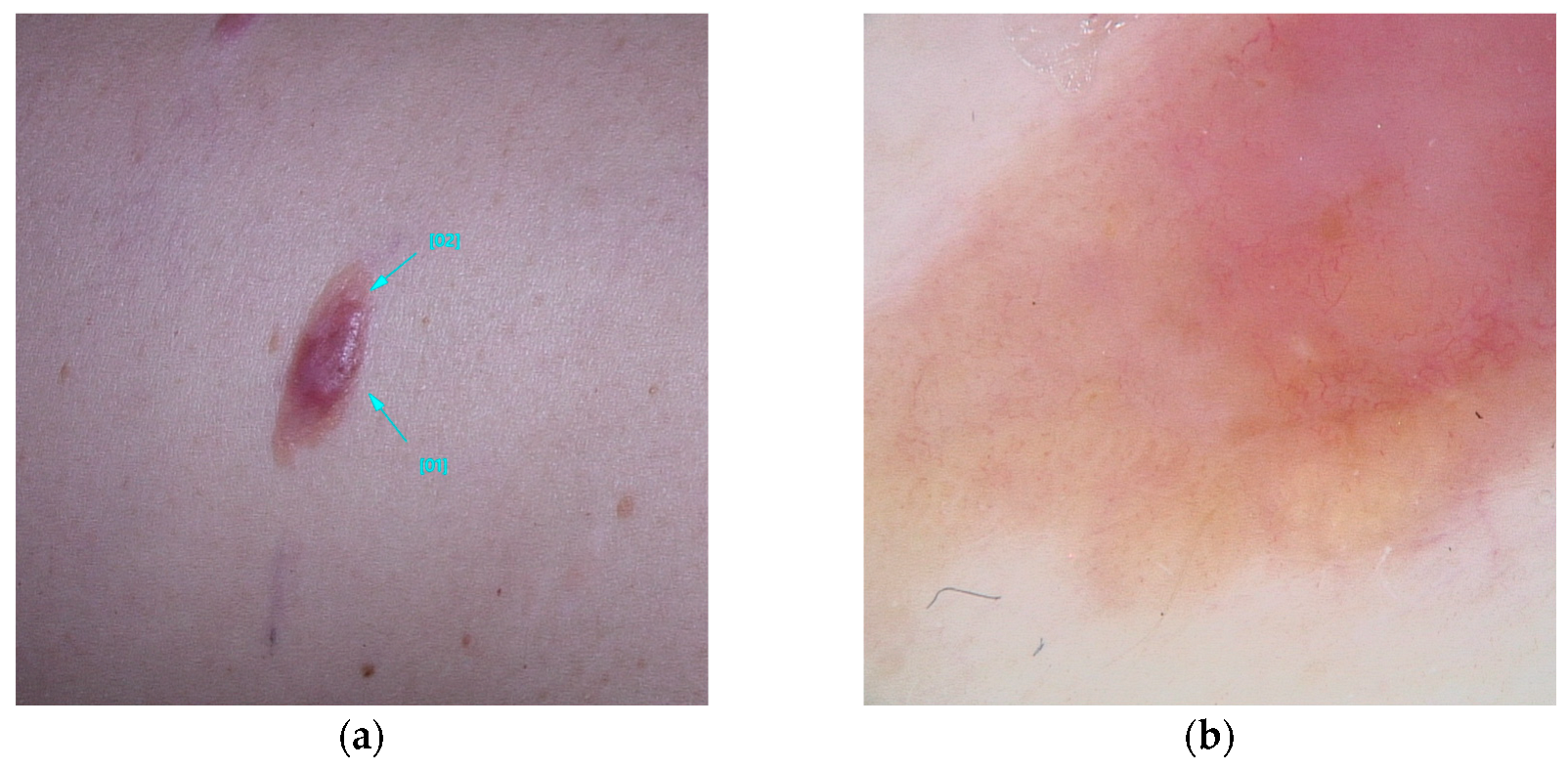 Diseases 13 00180 g001