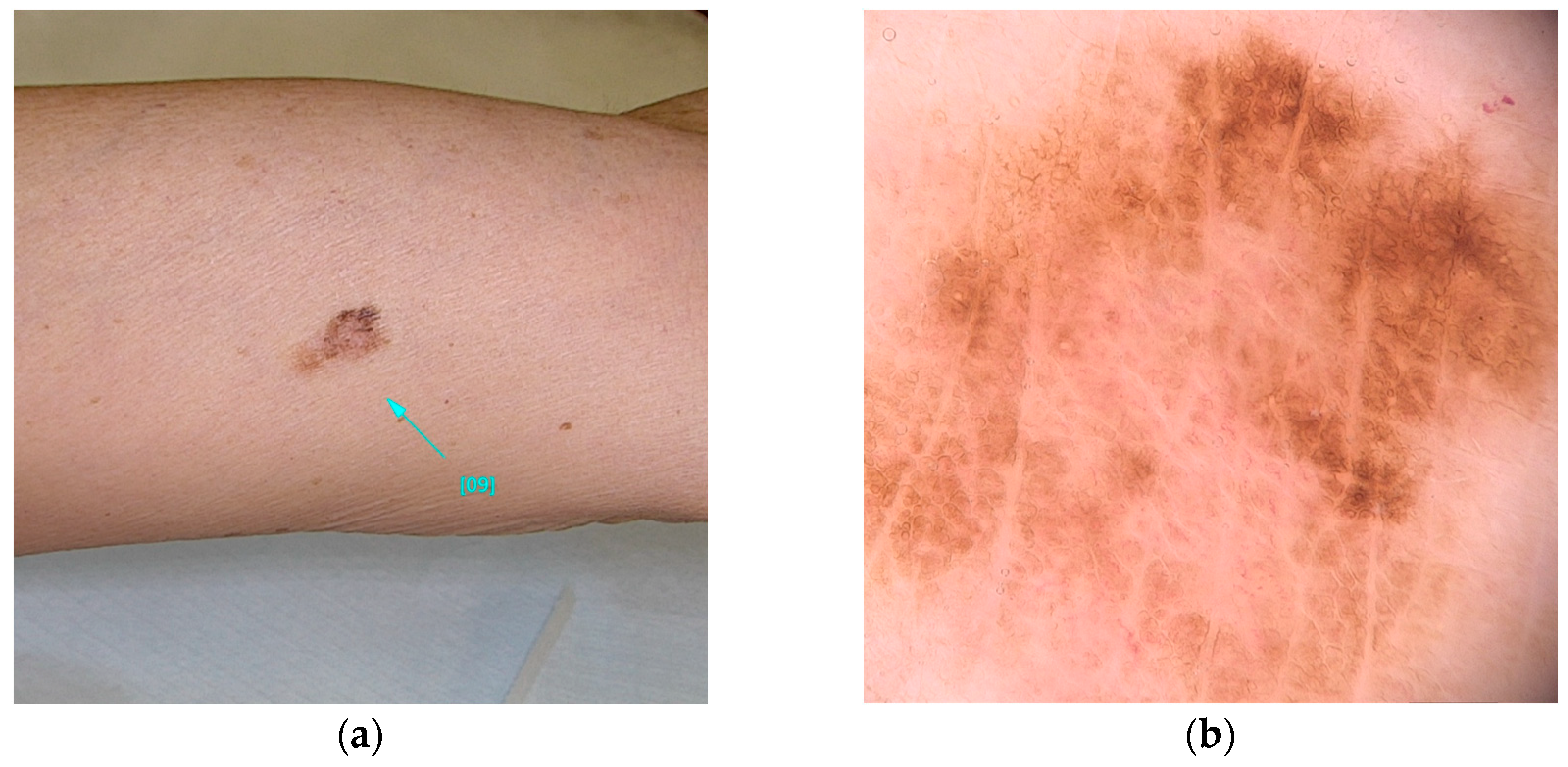 Diseases 13 00180 g002