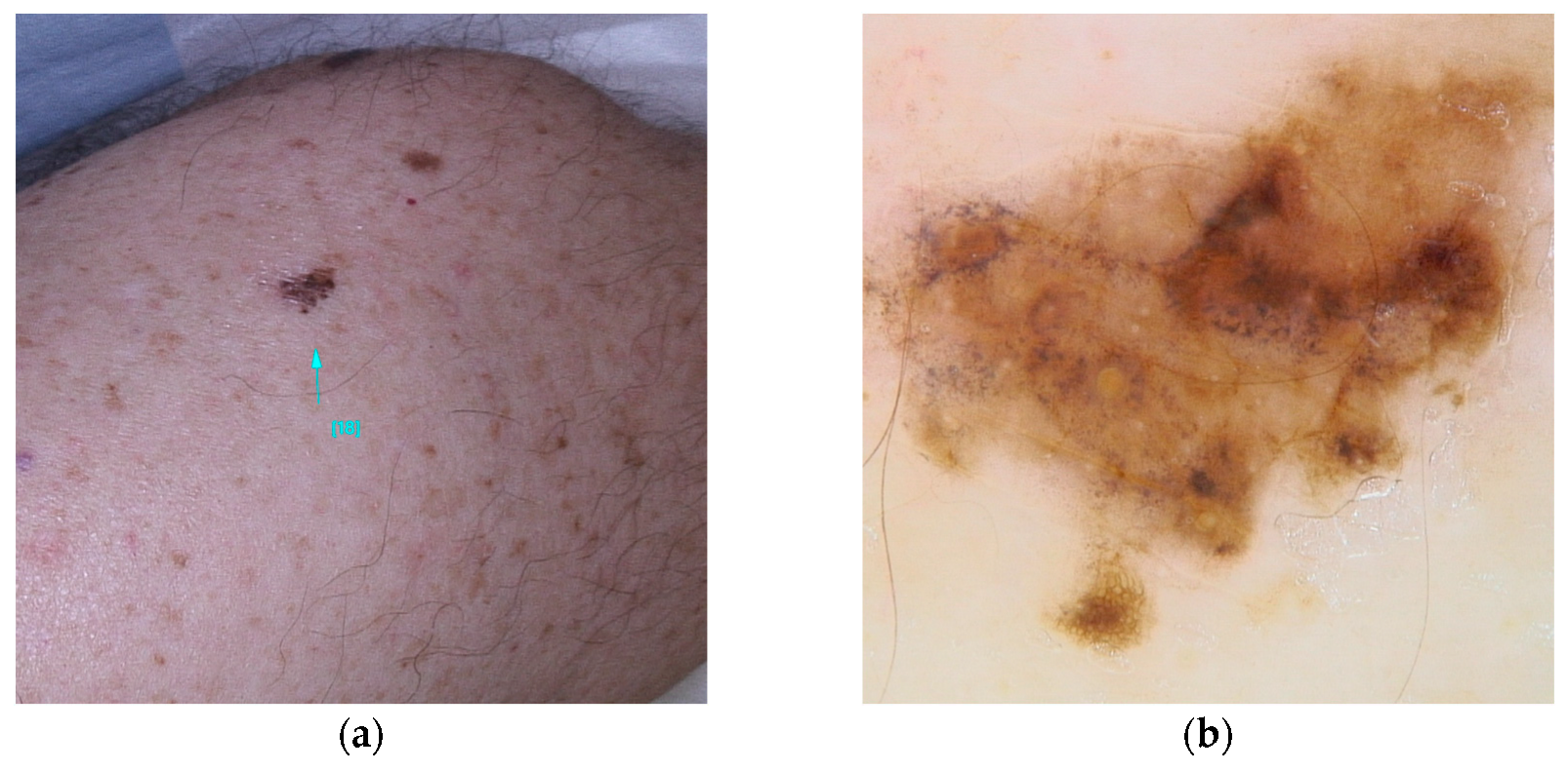 Diseases 13 00180 g005