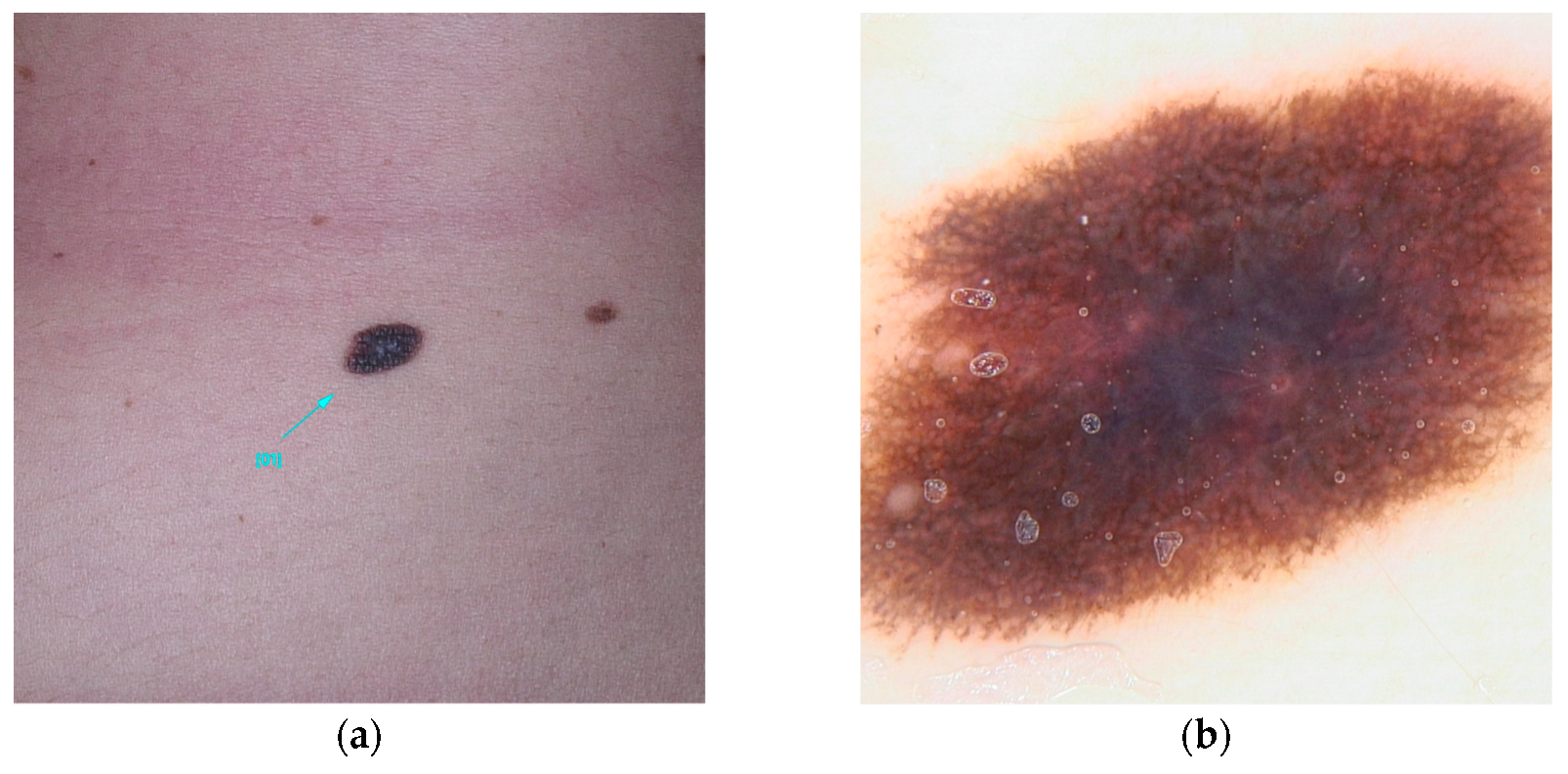 Diseases 13 00180 g006