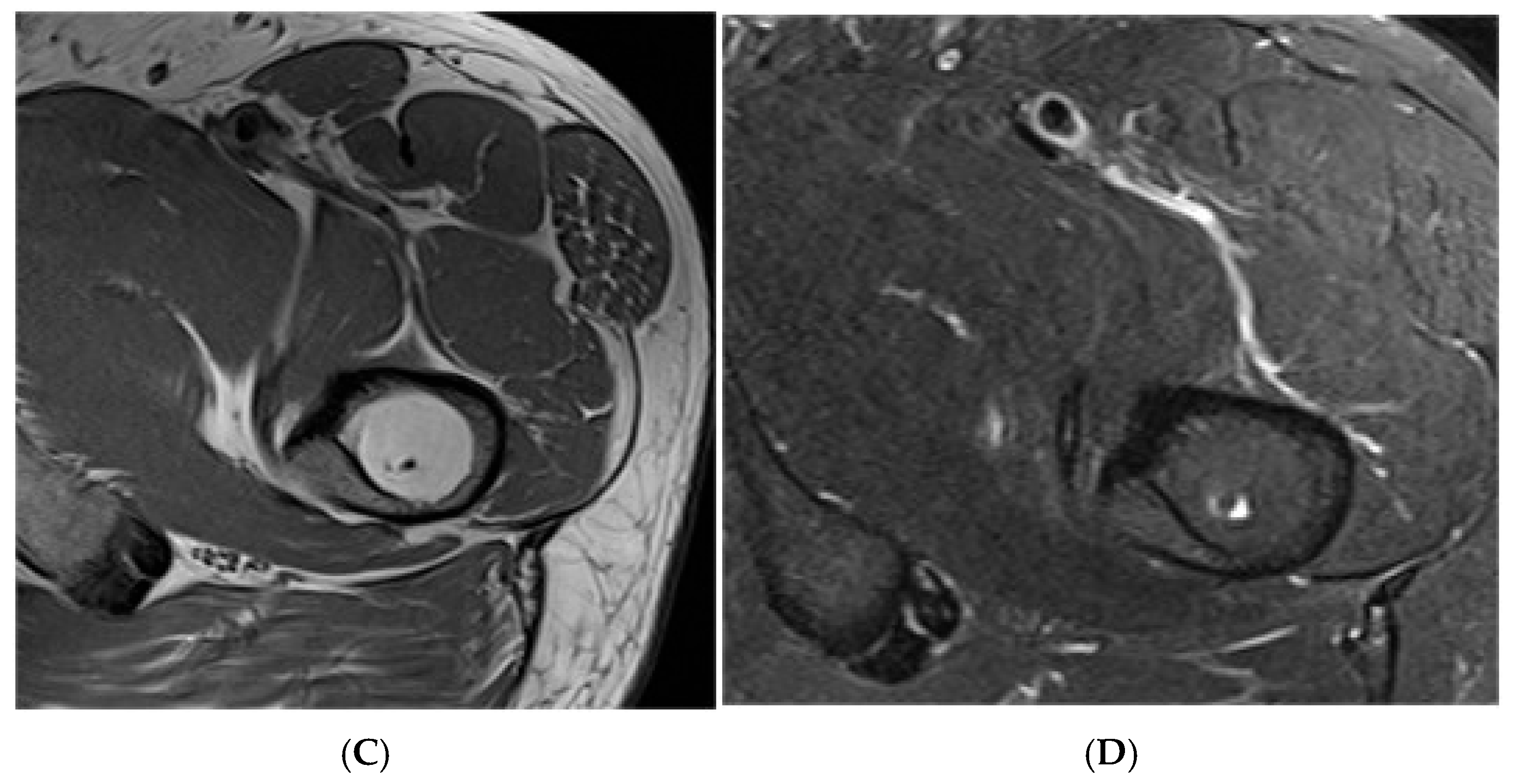Diseases 13 00197 g001b