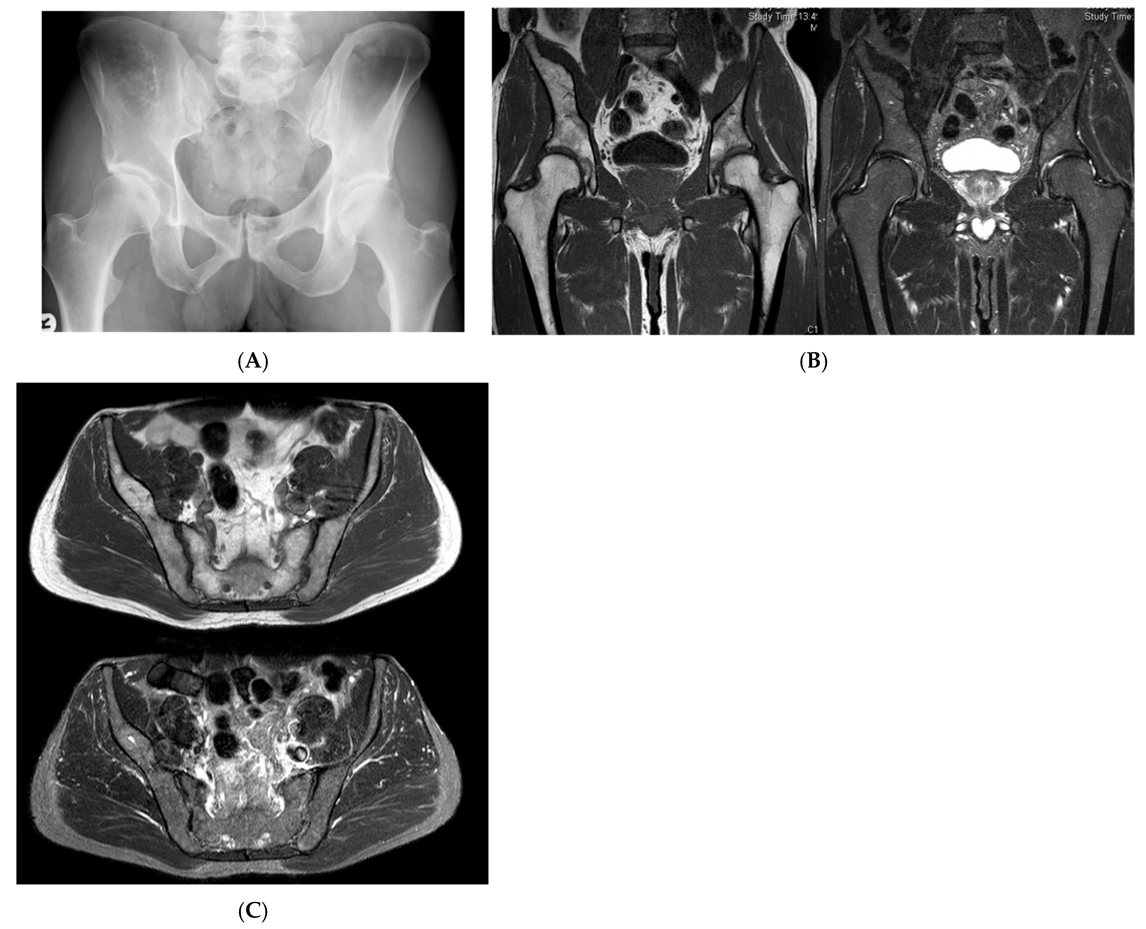 Diseases 13 00197 g002