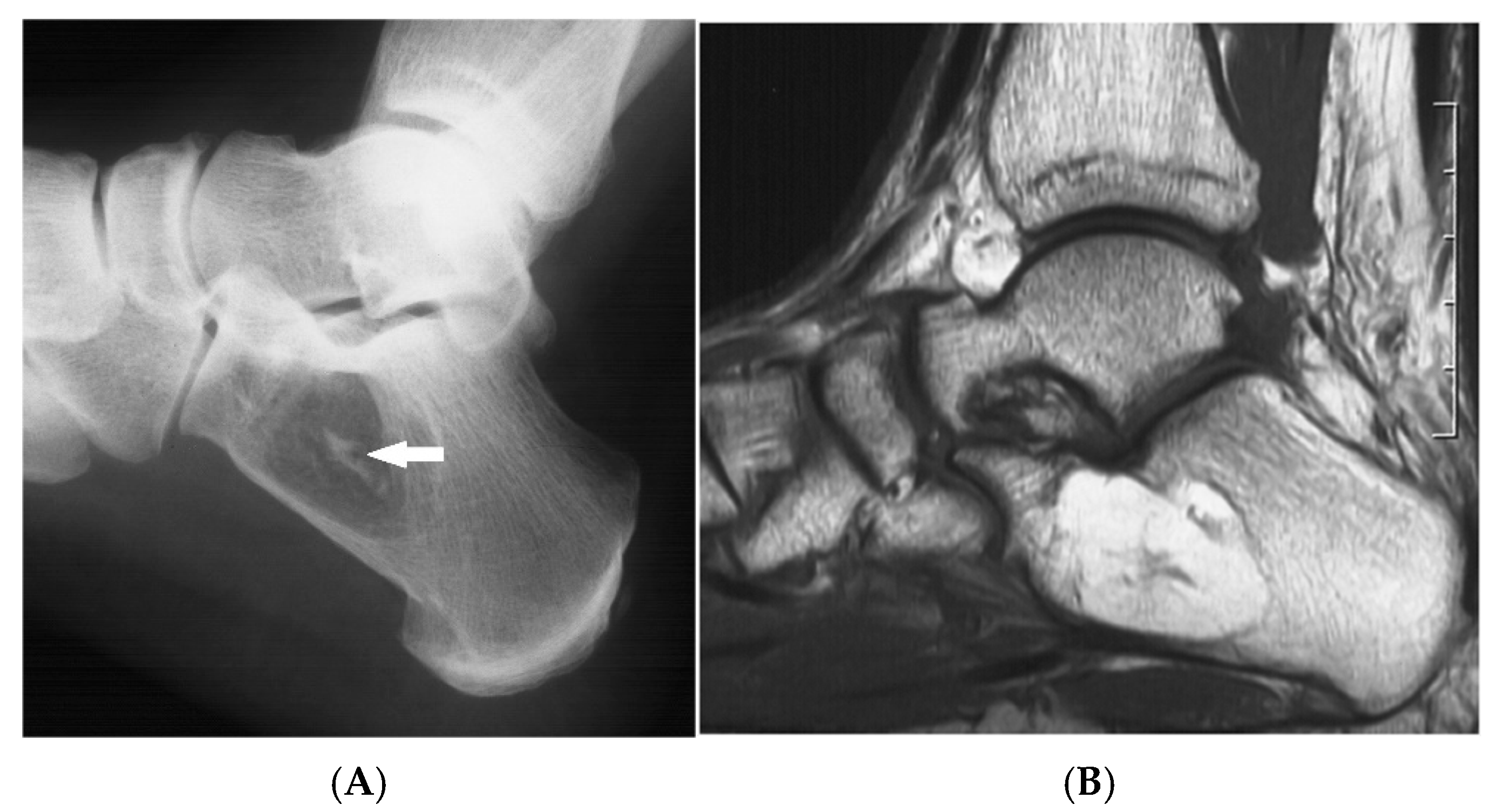 Diseases 13 00197 g003
