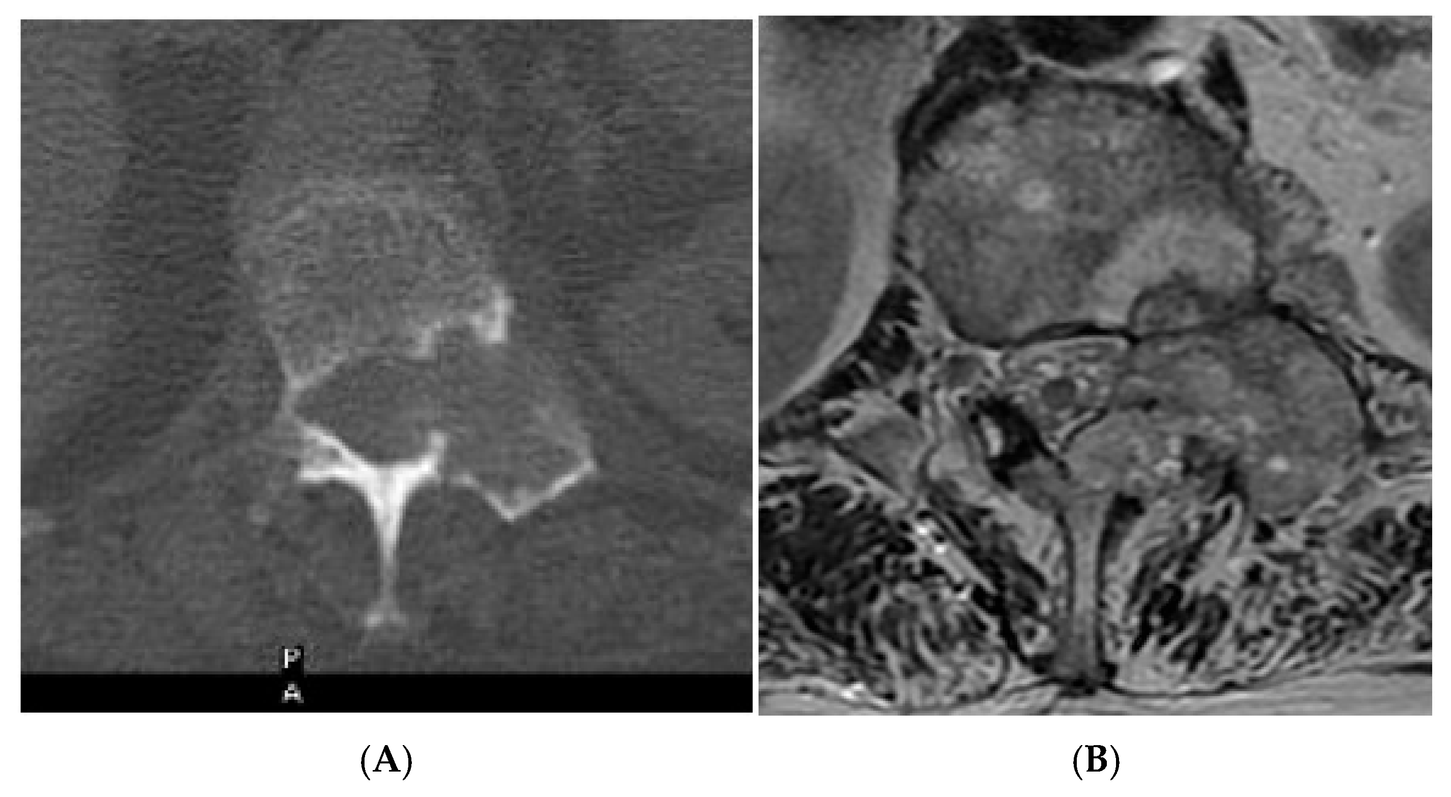 Diseases 13 00197 g013a