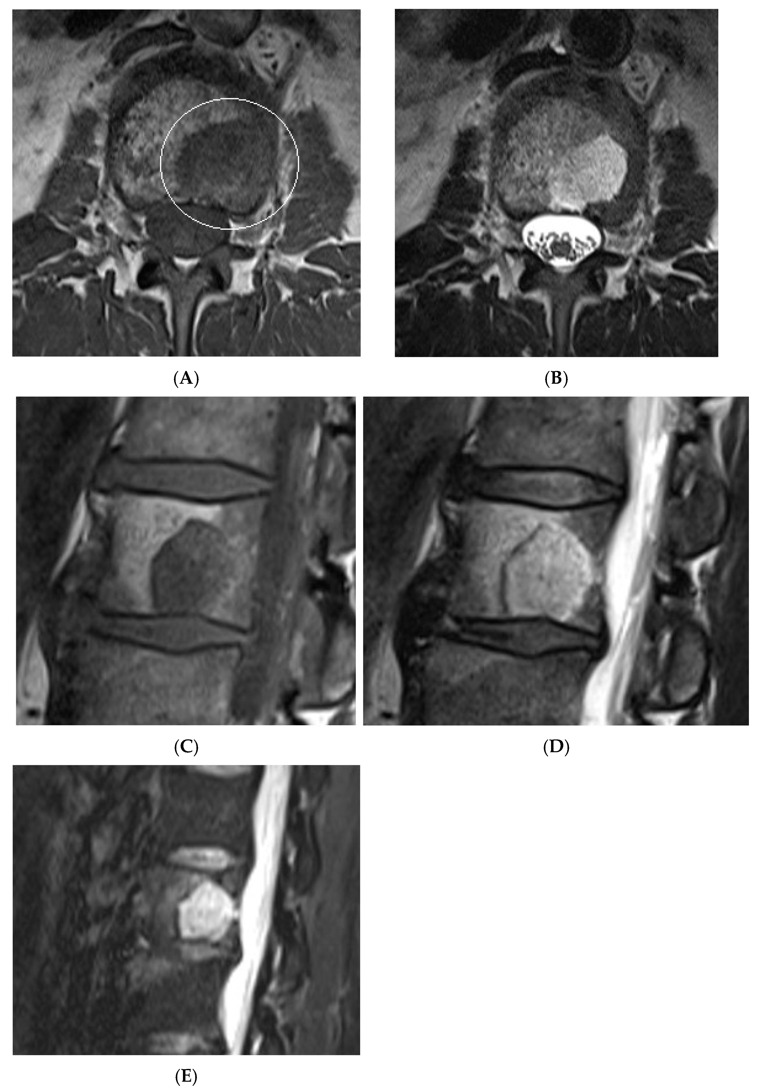Diseases 13 00197 g014