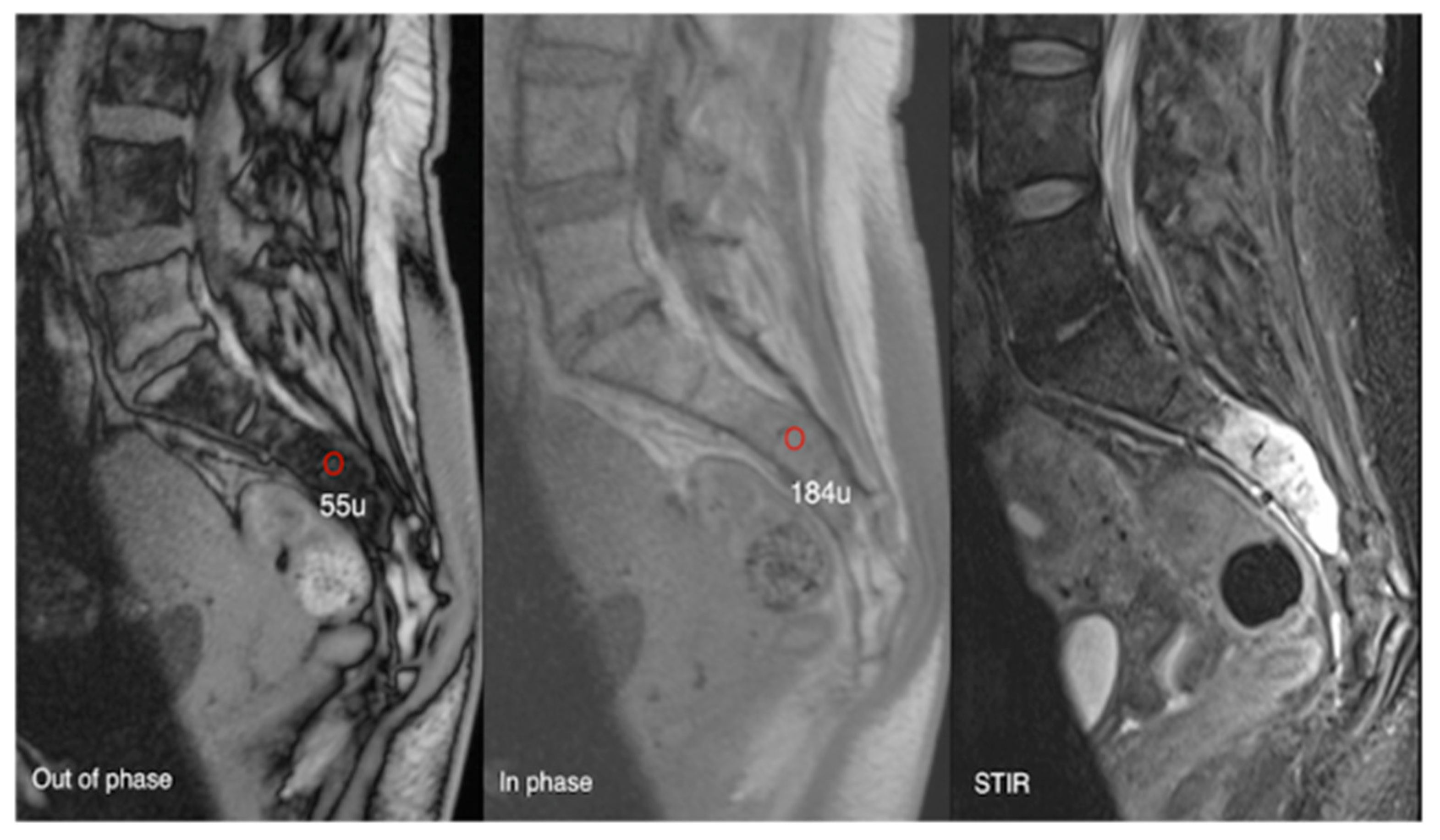 Diseases 13 00197 g017