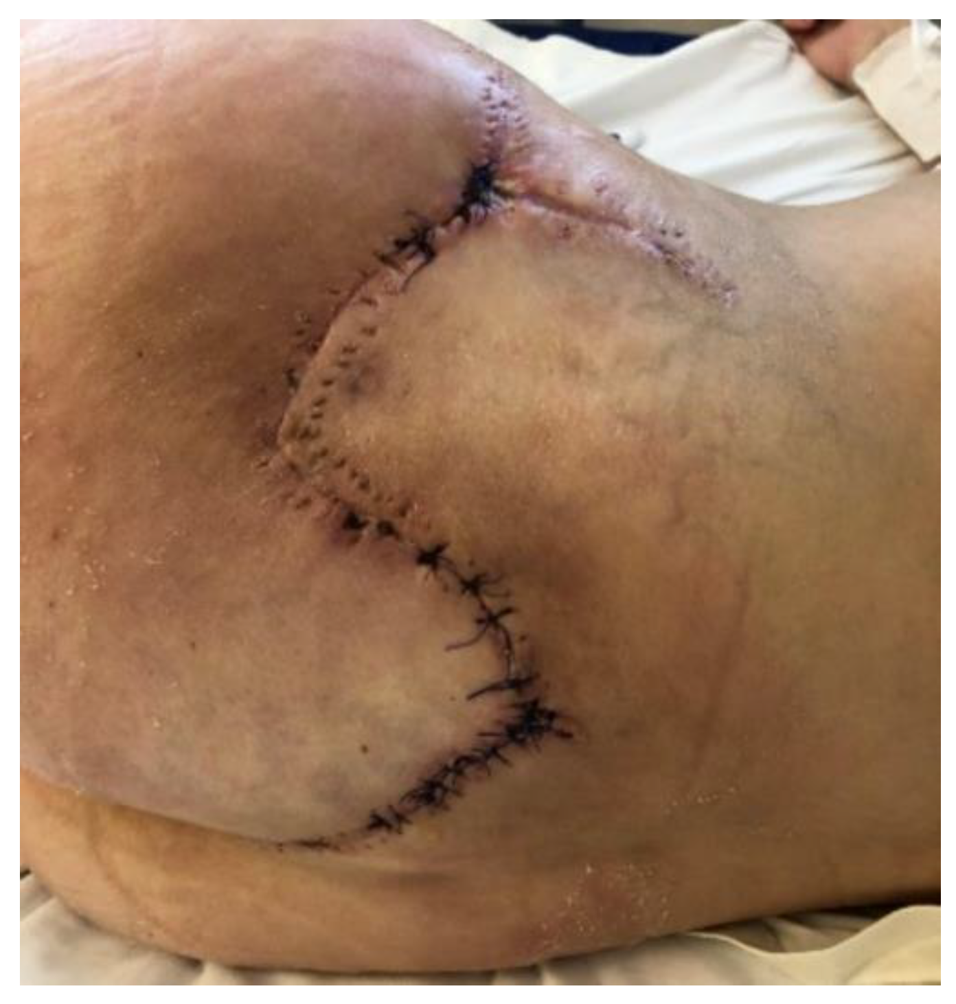 Diseases 13 00201 g004