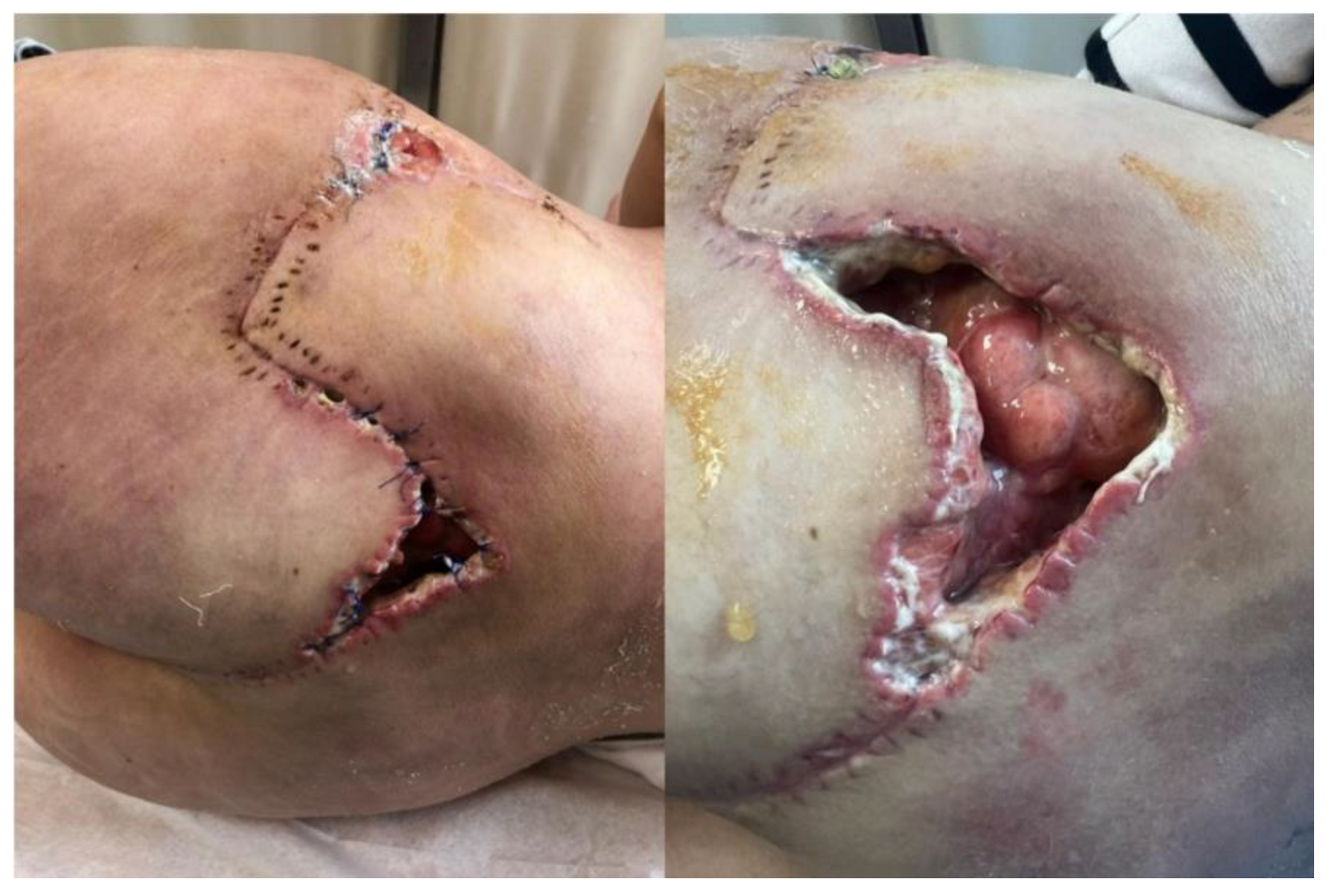 Diseases 13 00201 g006