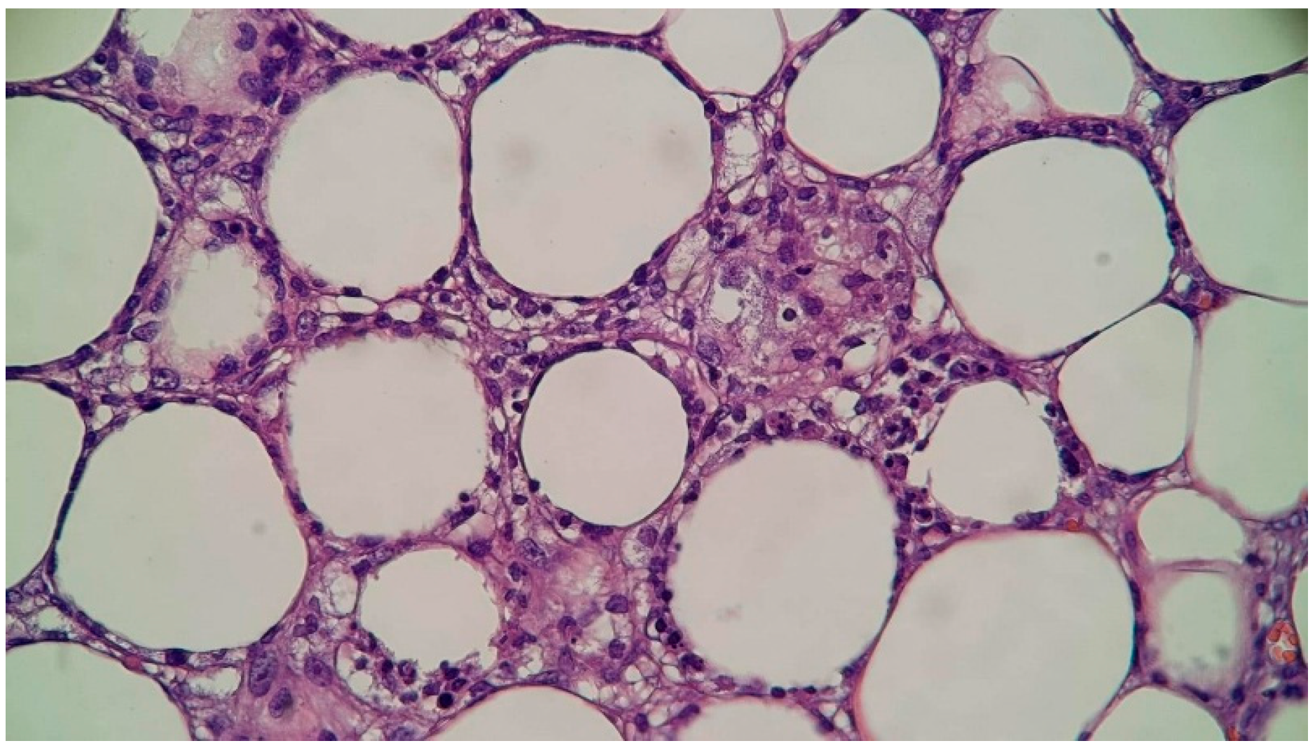 Diseases 13 00201 g007