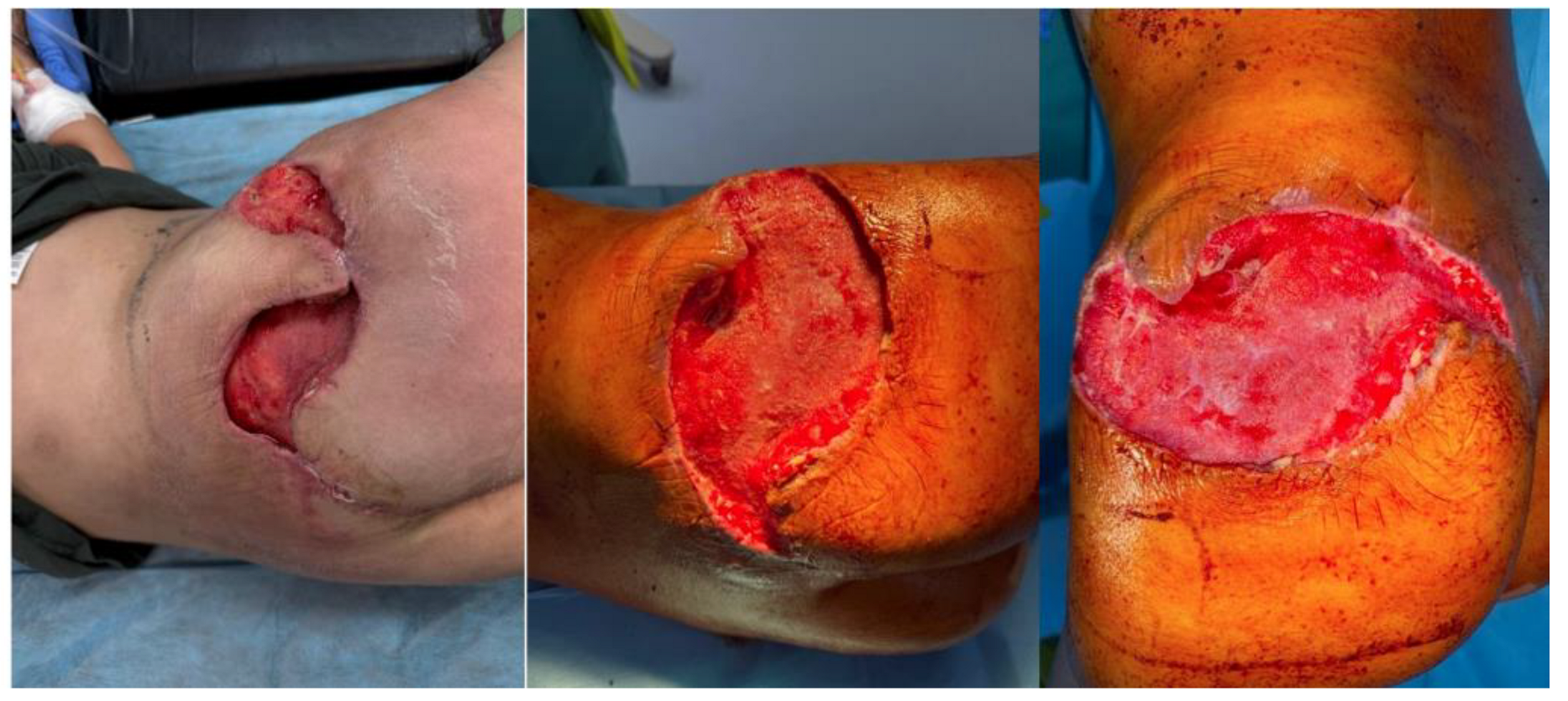 Diseases 13 00201 g010