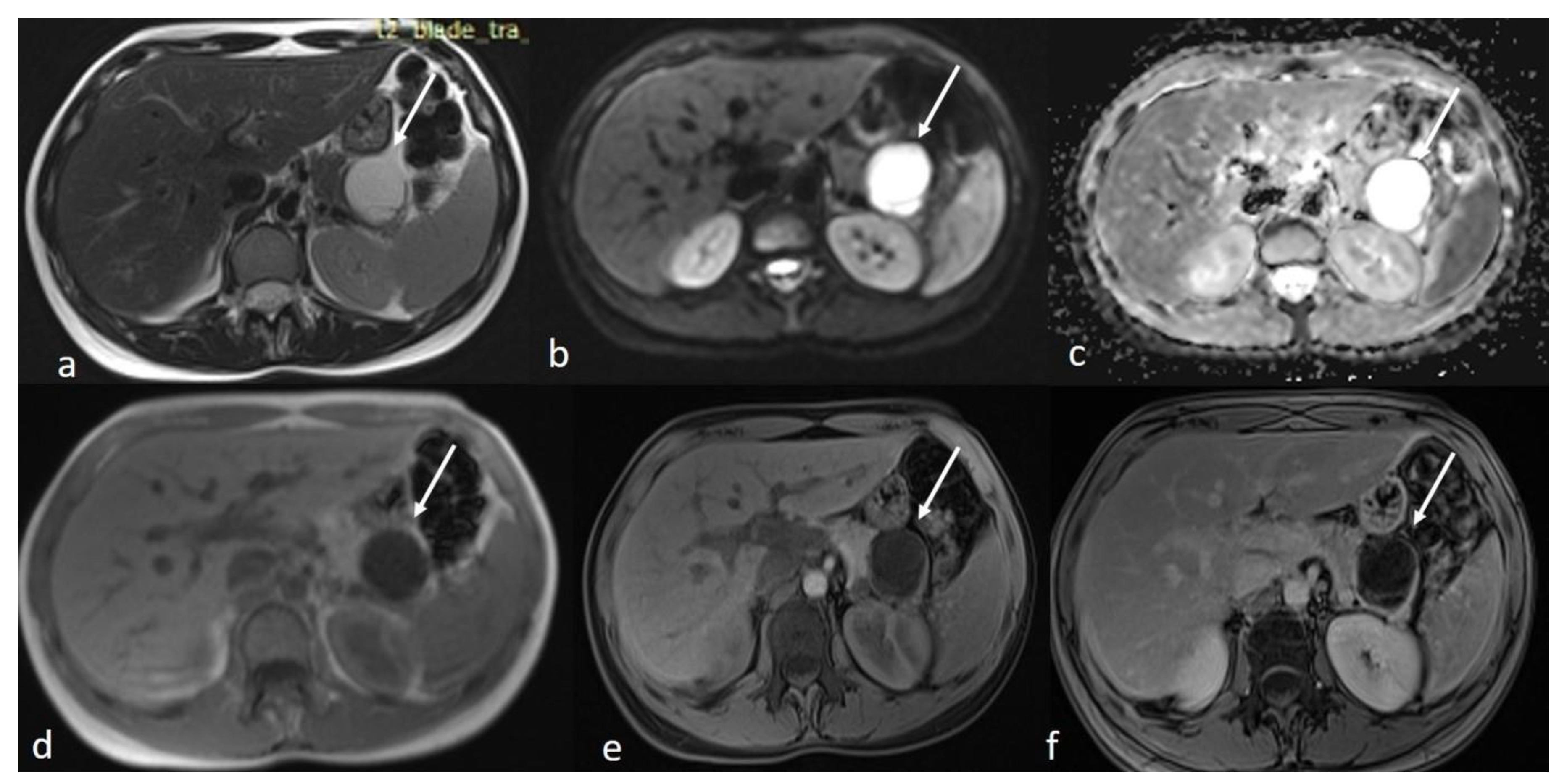 Diseases 13 00203 g002