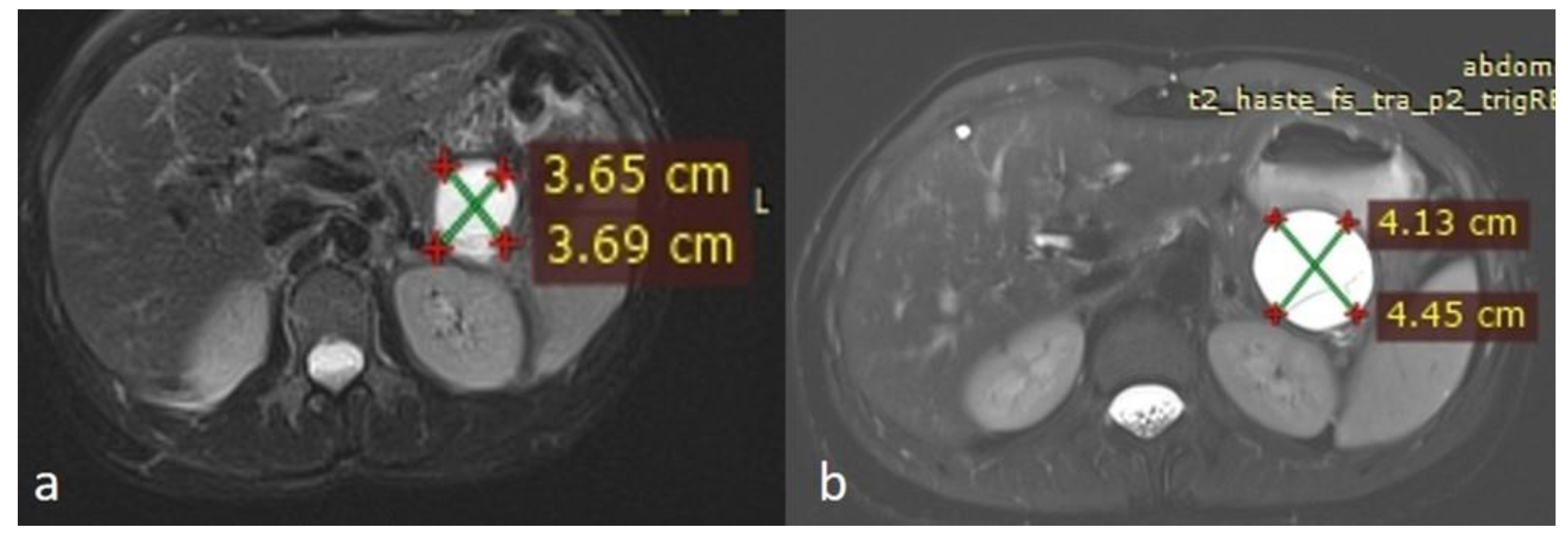 Diseases 13 00203 g003