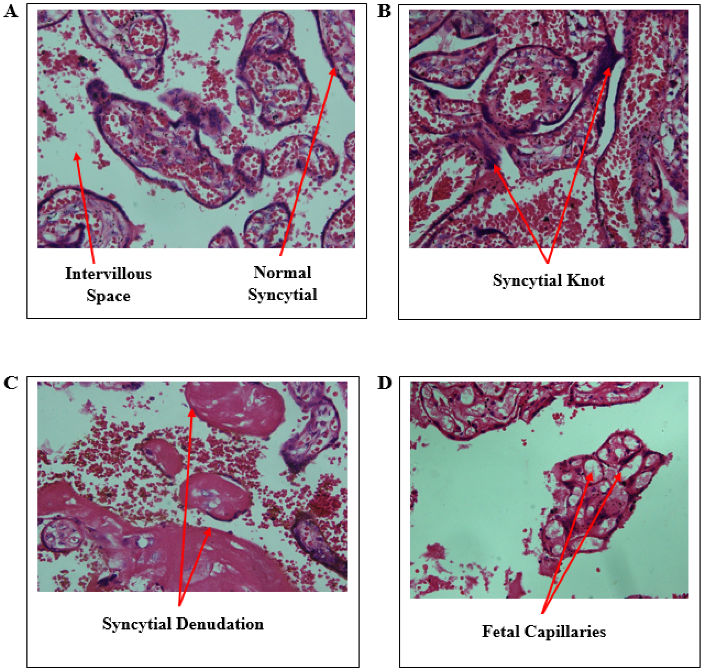 Diseases 13 00205 g003