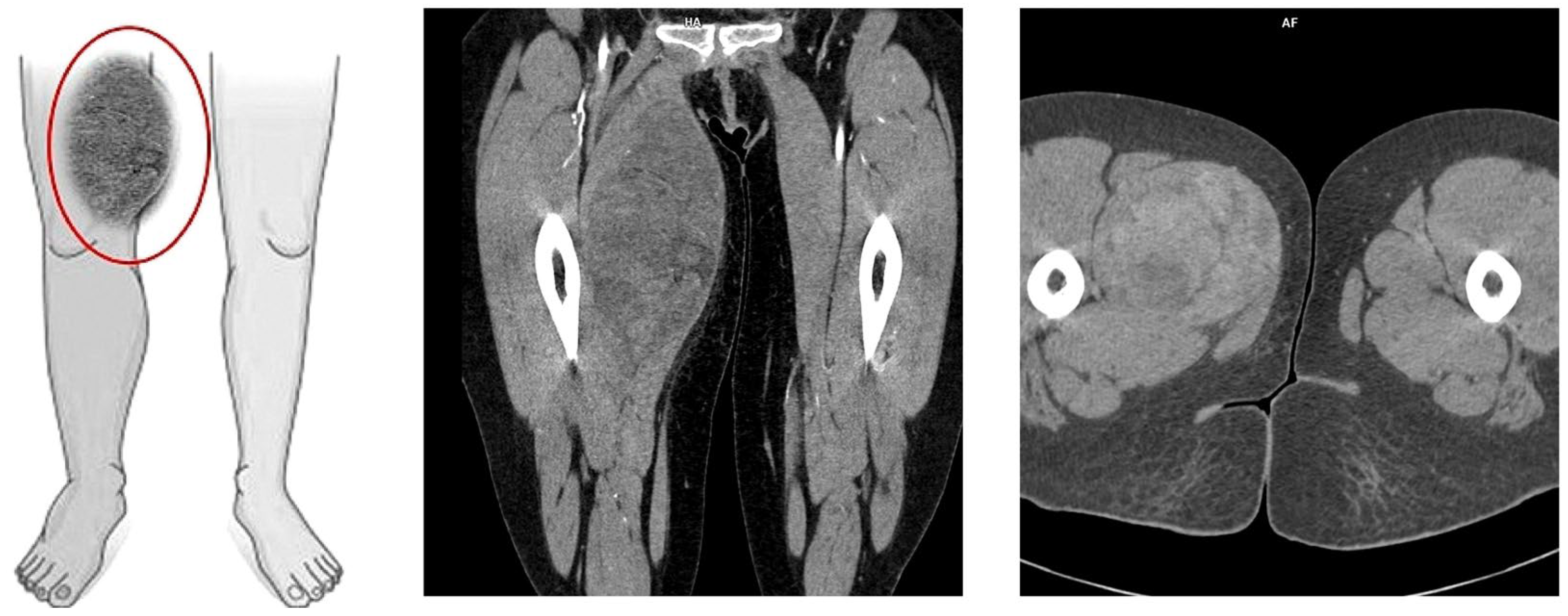 Diseases 13 00220 g002