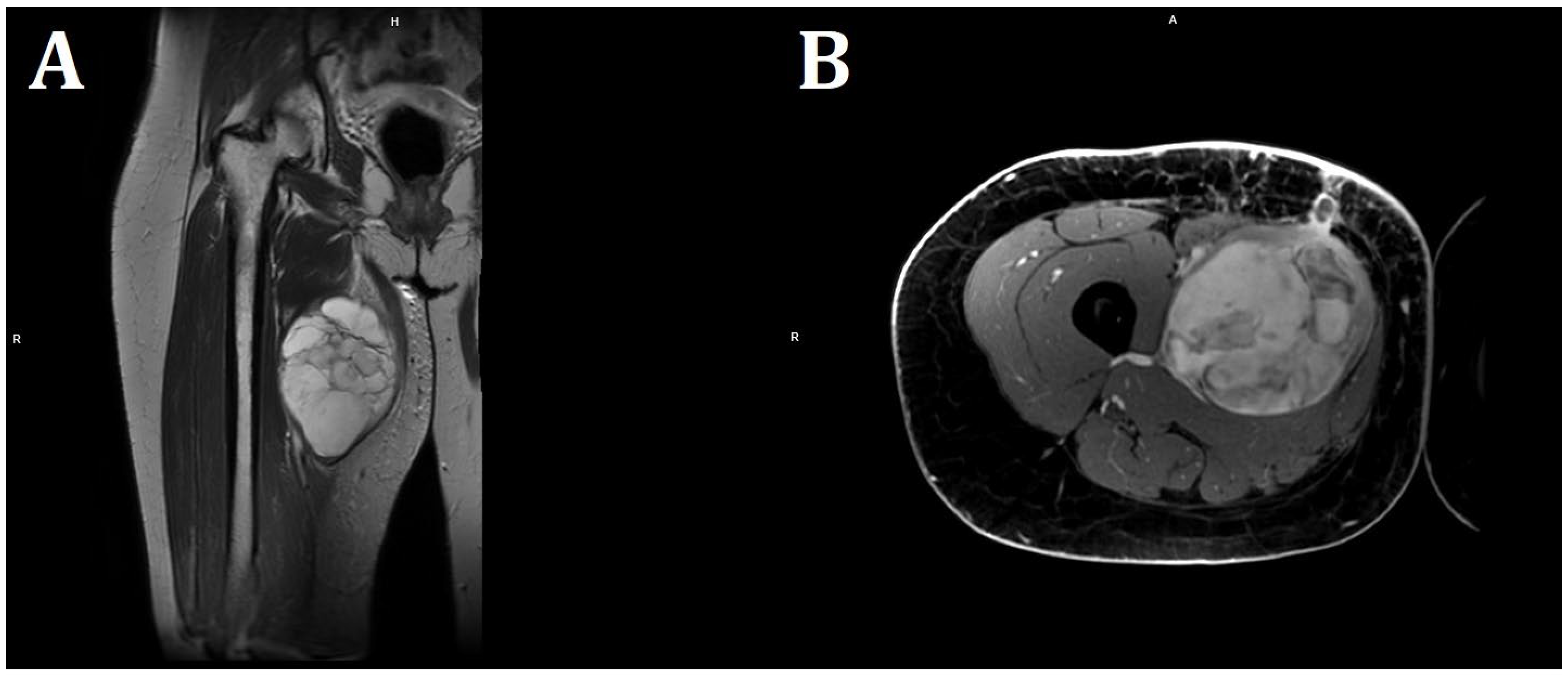 Diseases 13 00220 g003