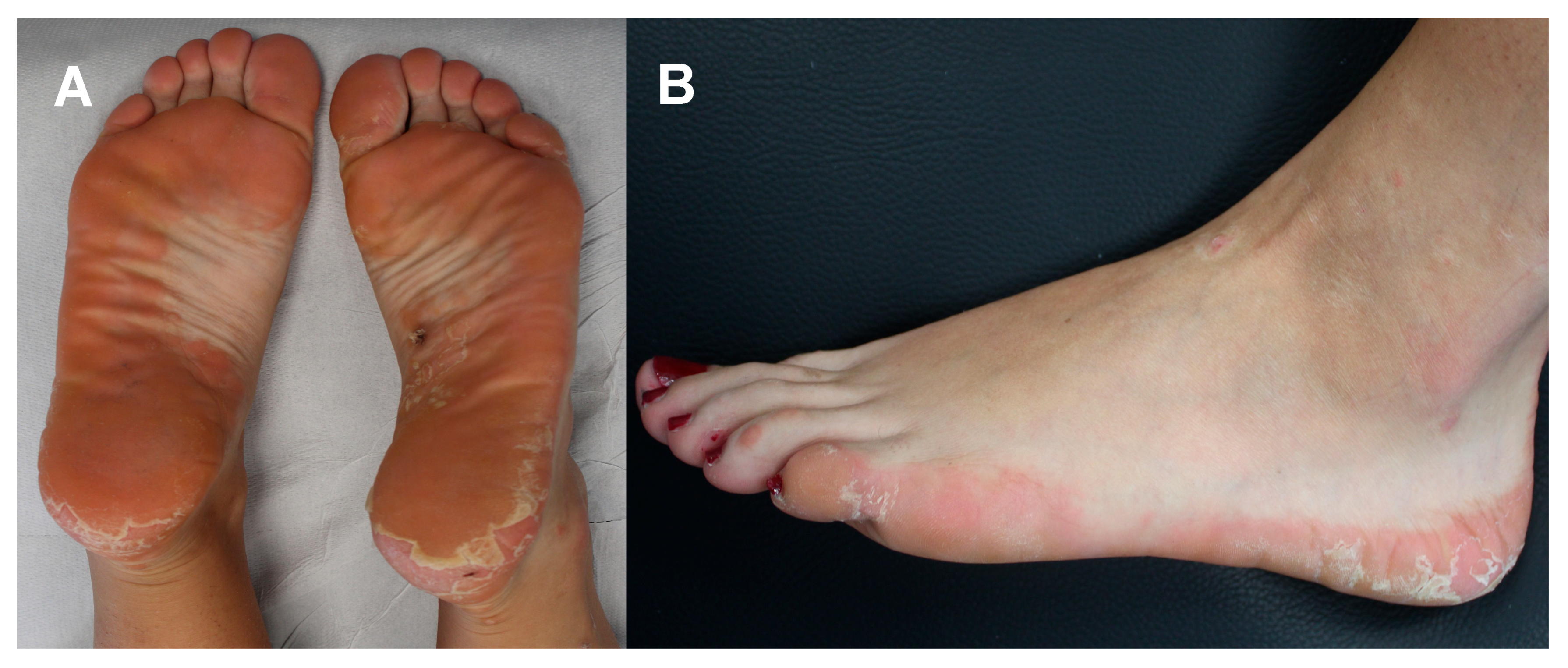 Diseases 13 00225 g001