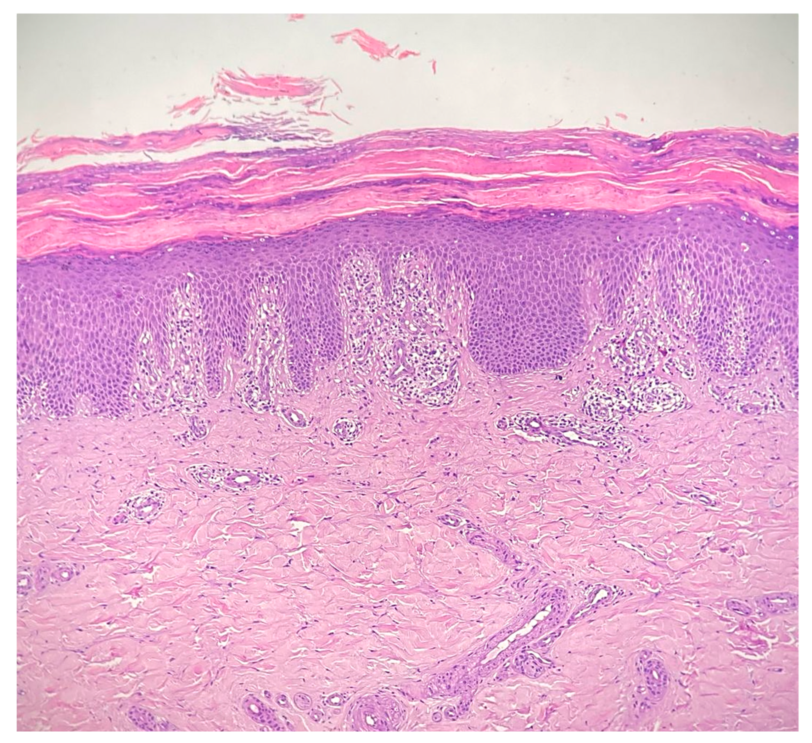 Diseases 13 00225 g002