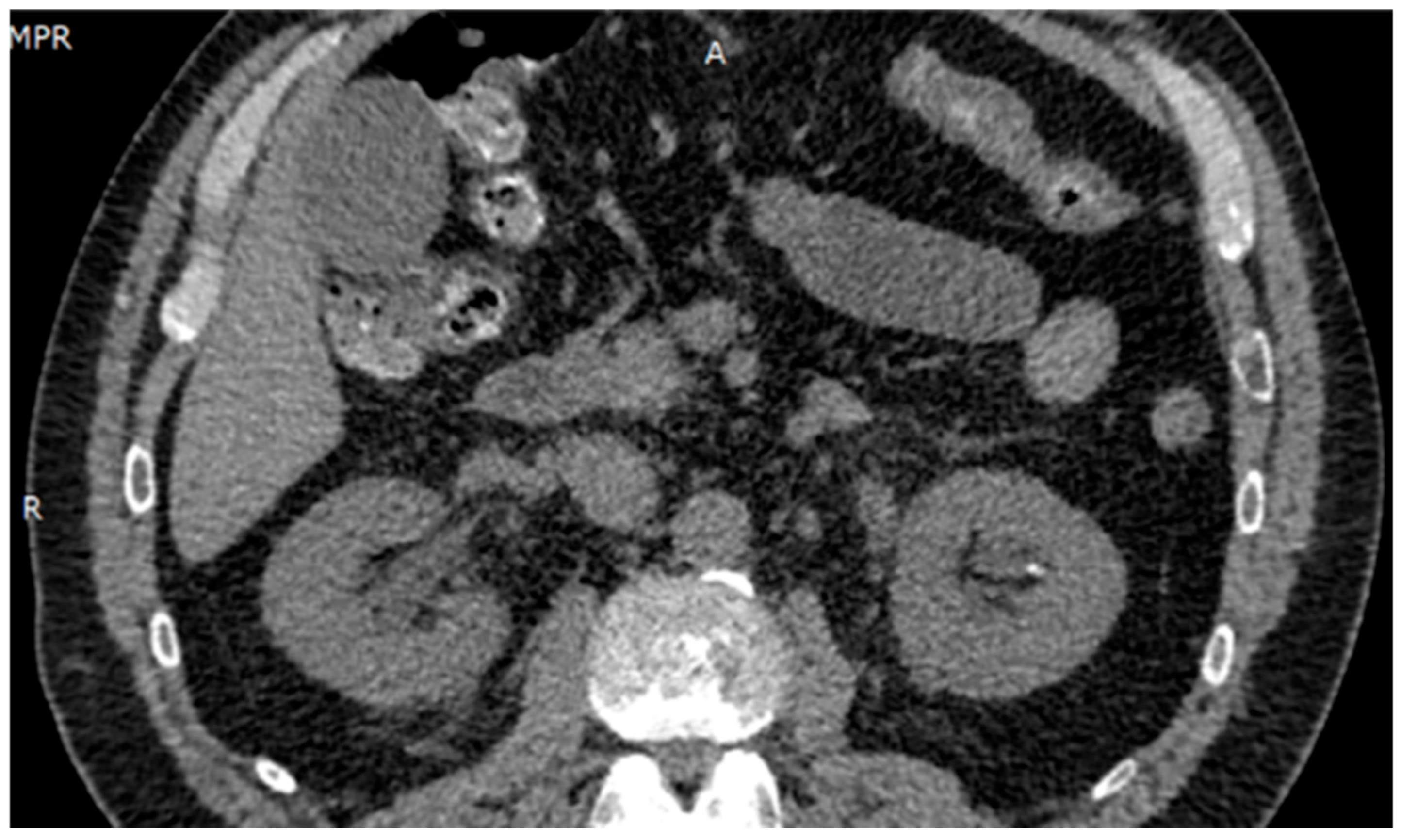 Diseases 13 00228 g001