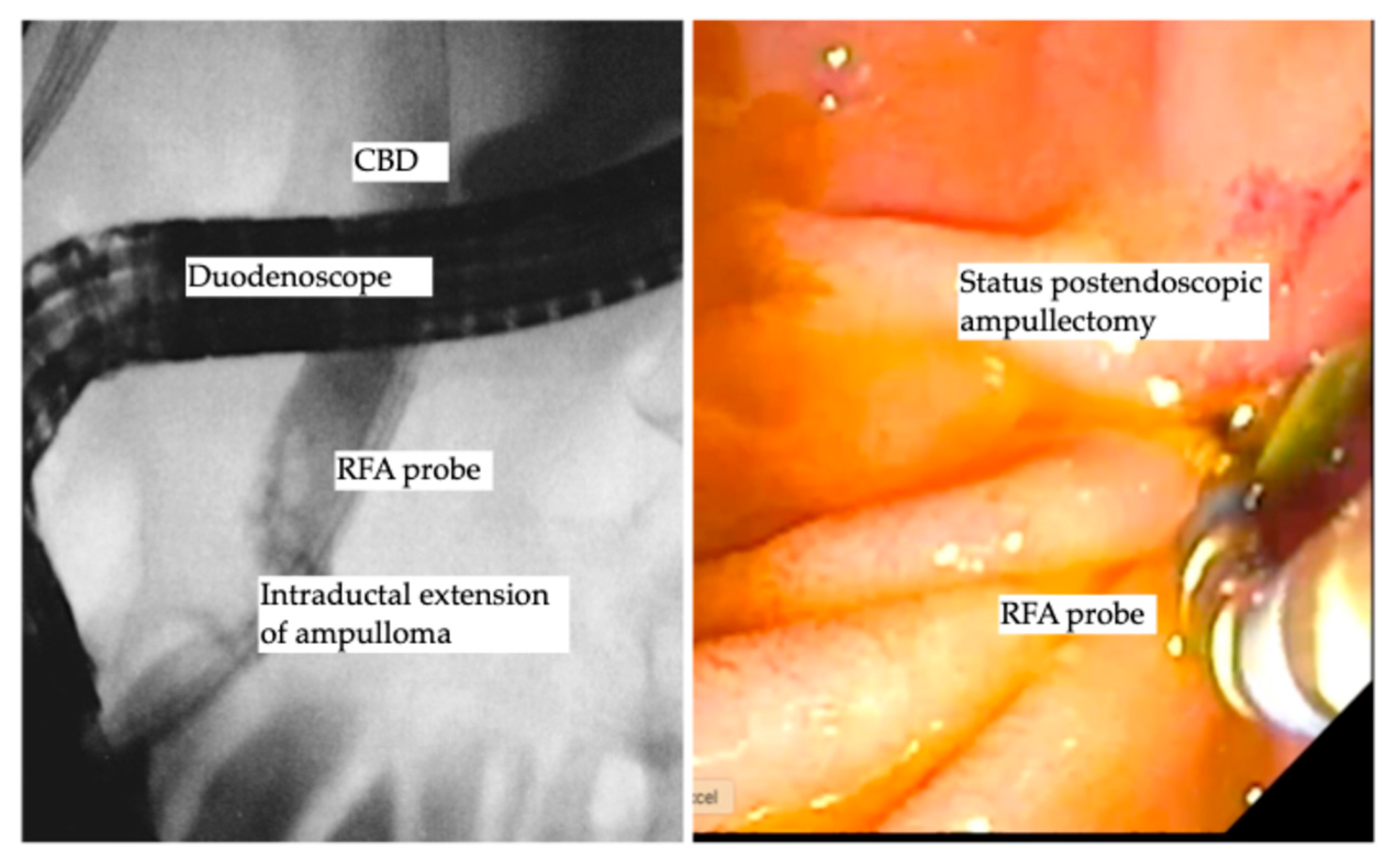 Diseases 13 00273 g003