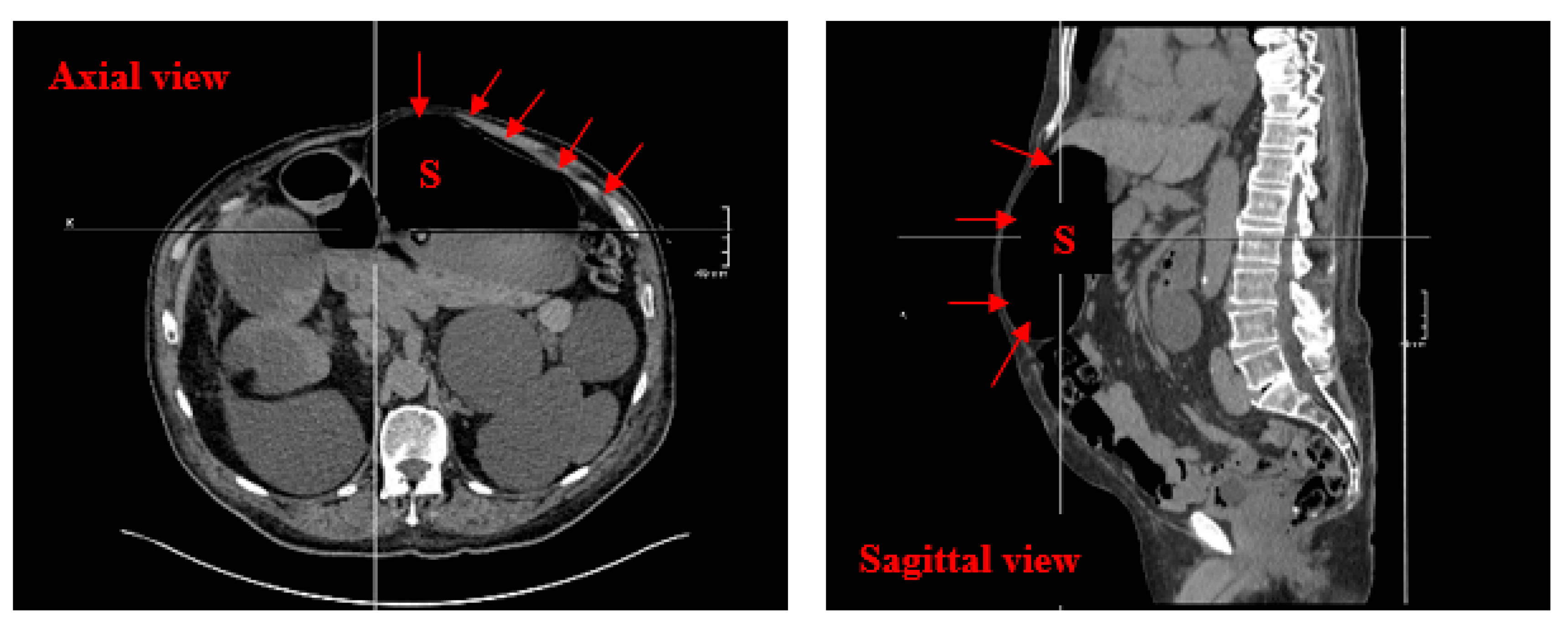 Diseases 13 00306 g001