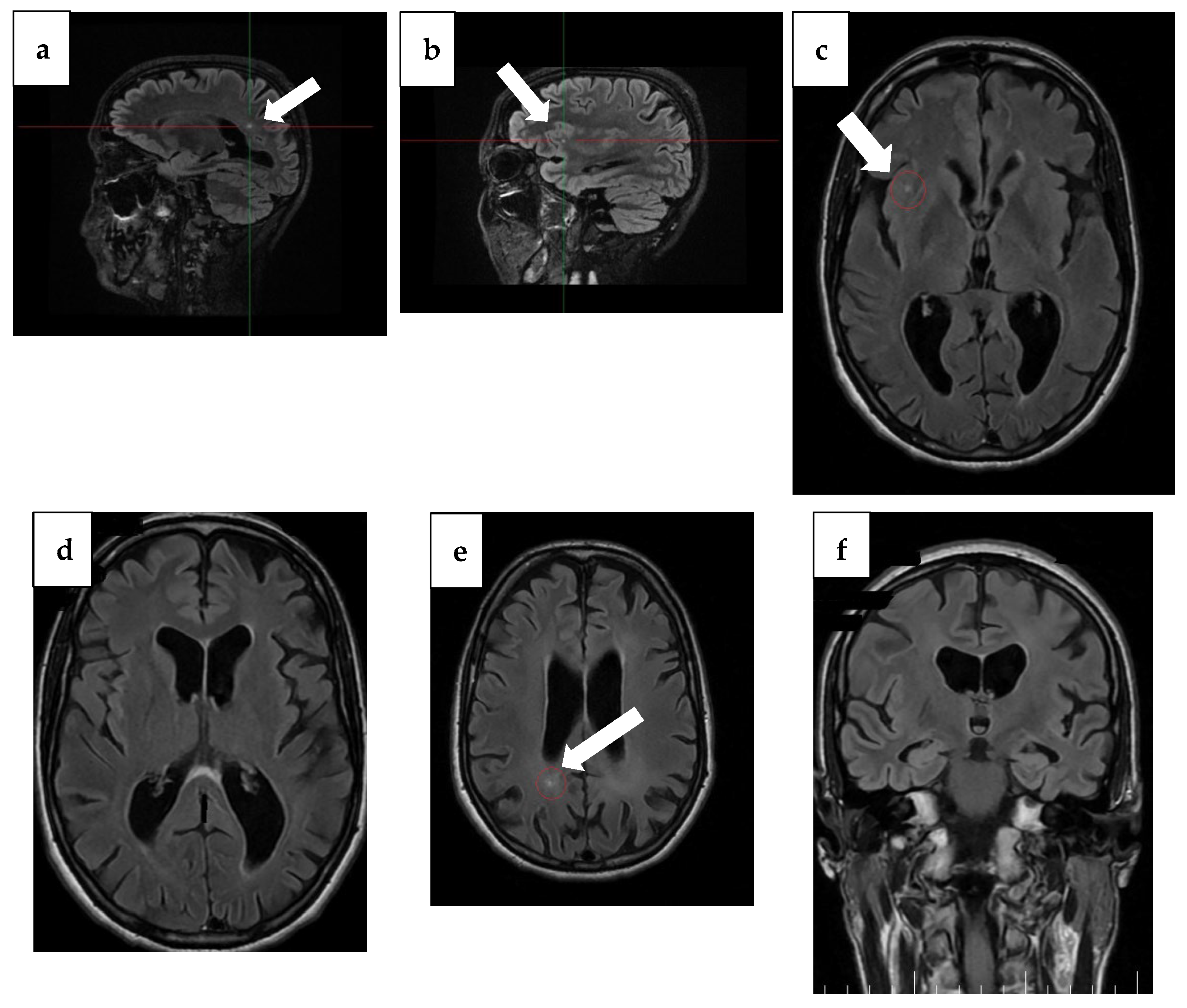 Diseases 13 00310 g002