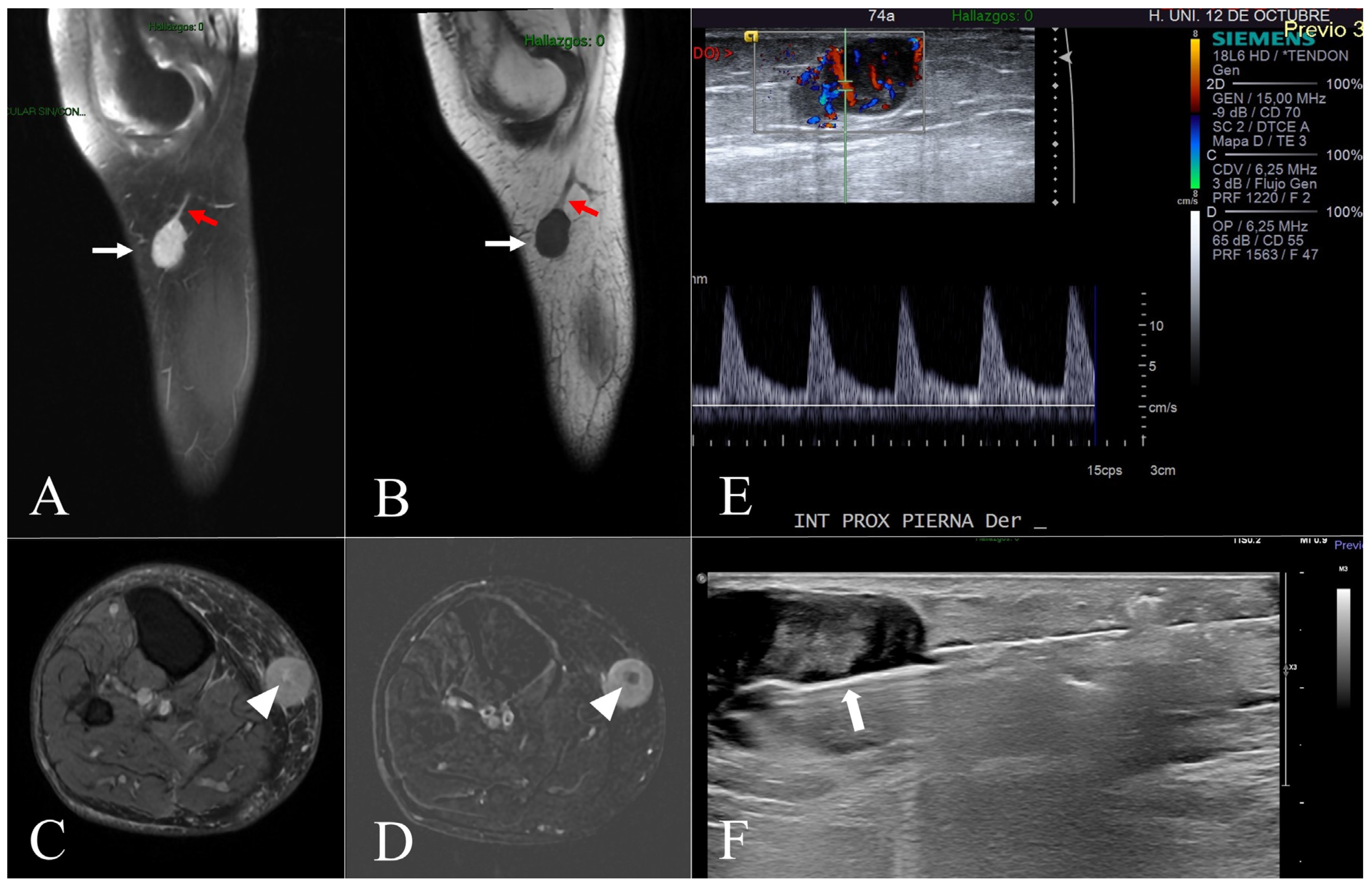 Diseases 13 00330 g002