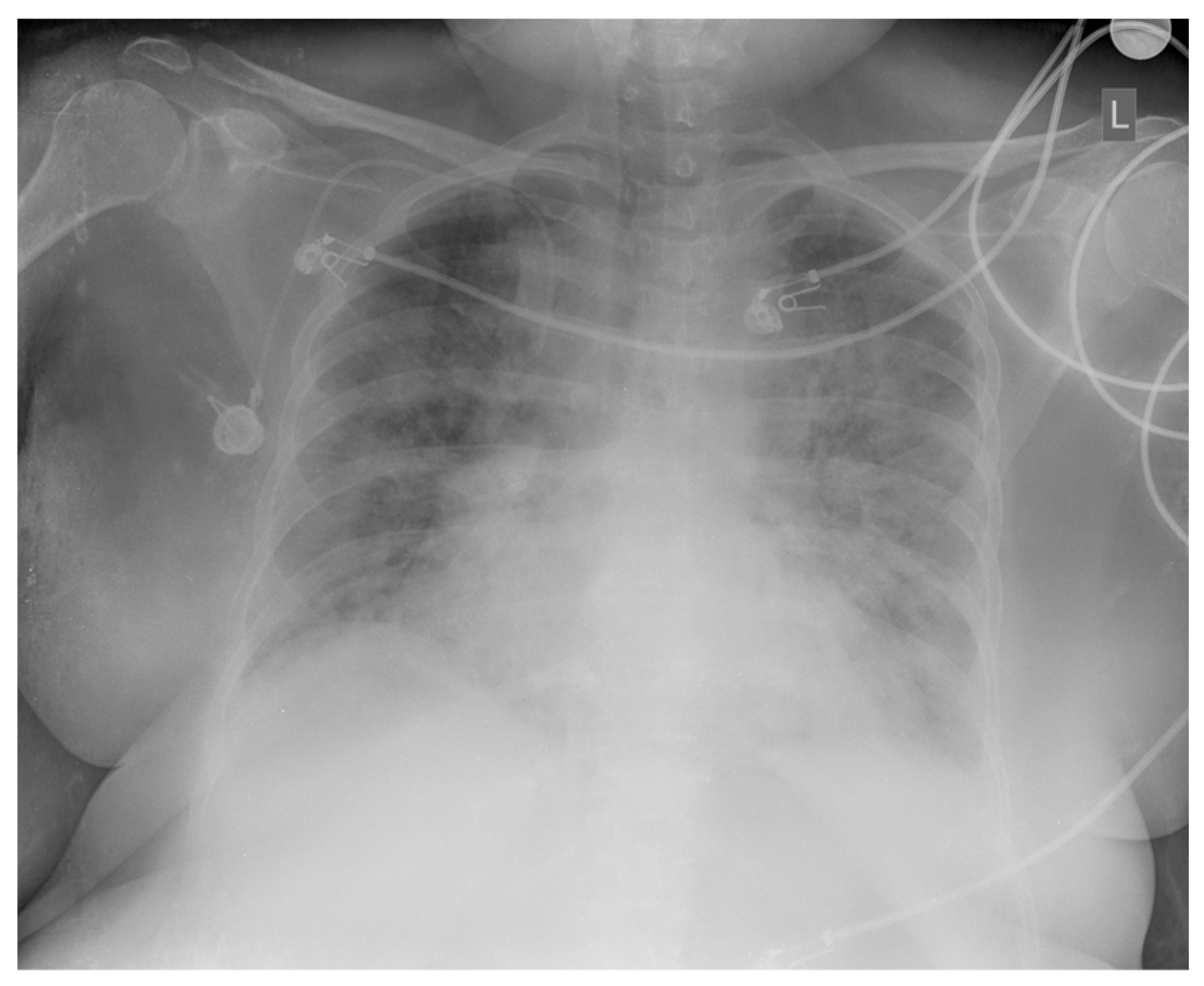 Diseases 13 00339 g004