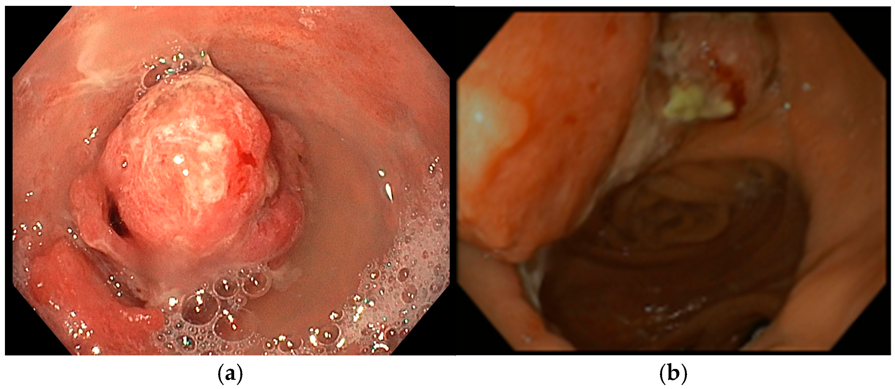 Diseases 13 00340 g003