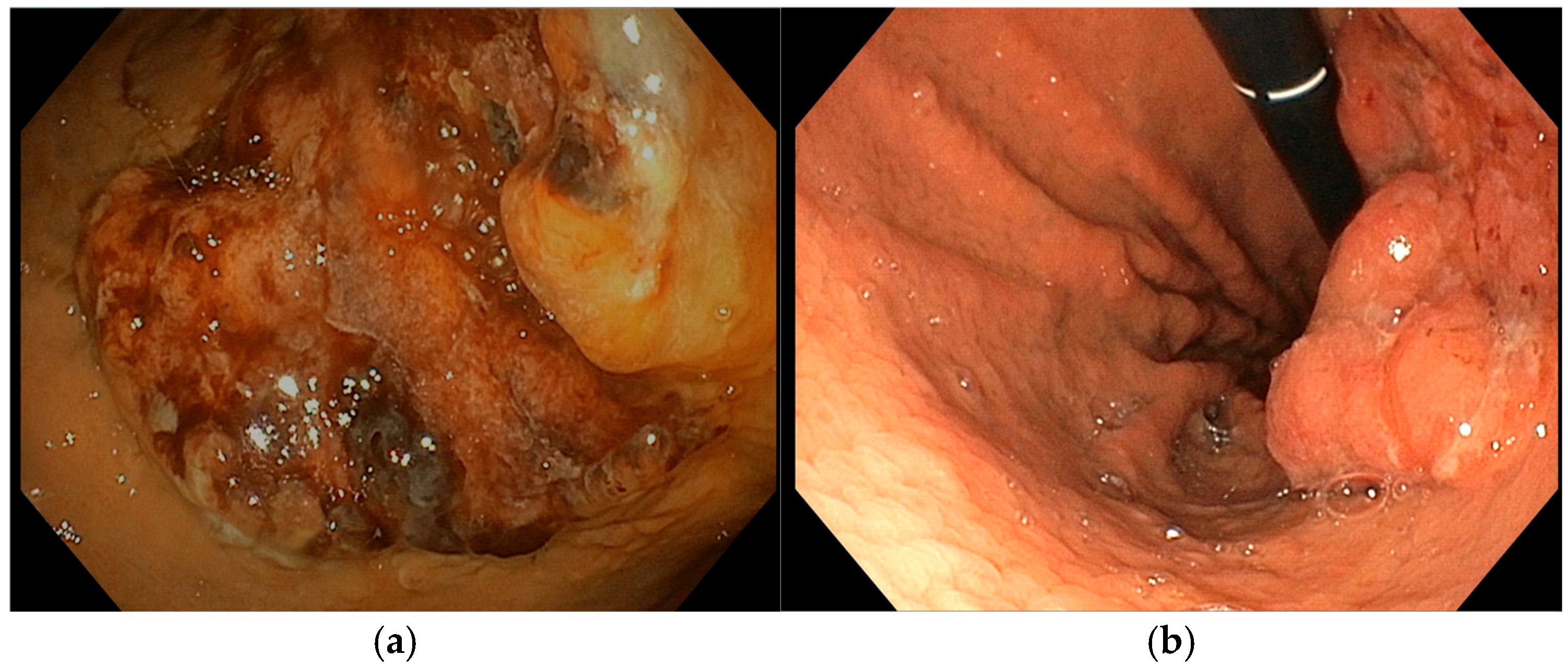 Diseases 13 00340 g004