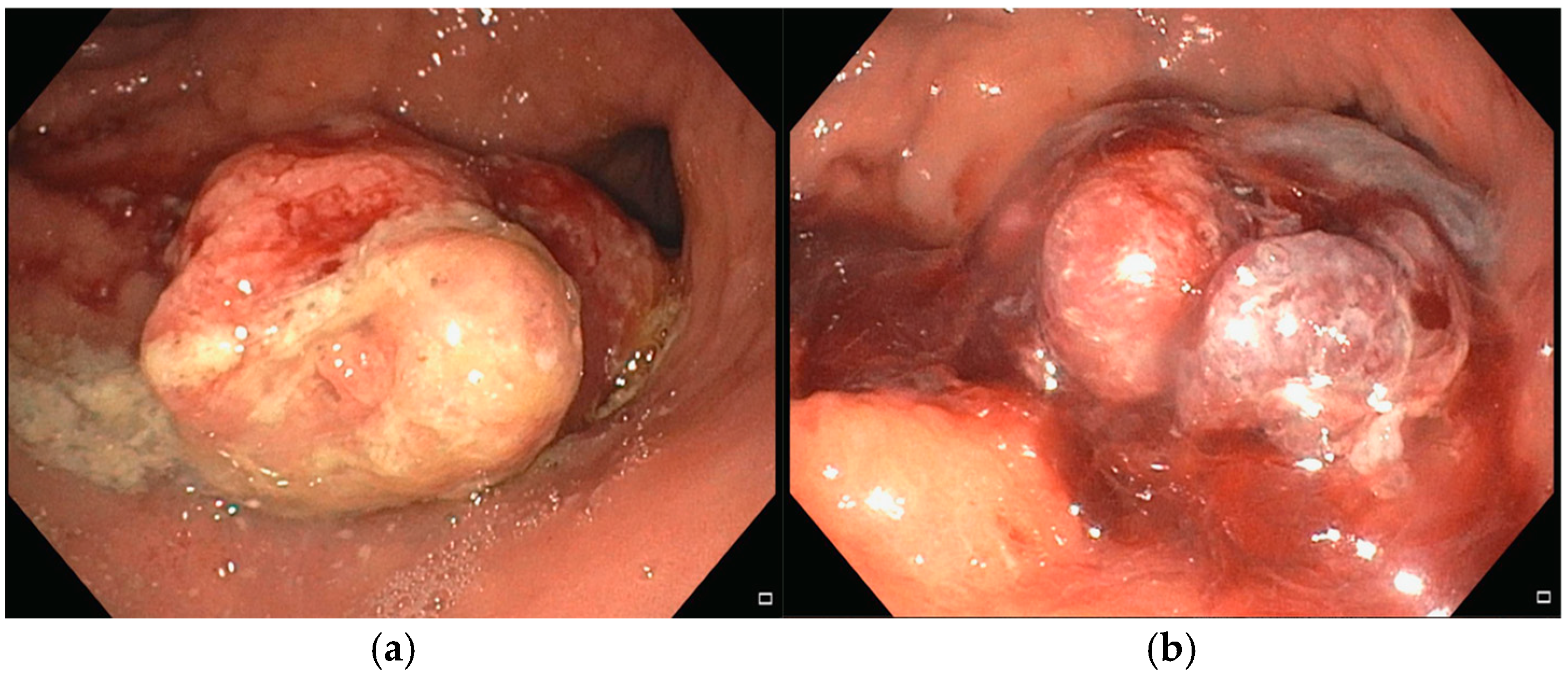 Diseases 13 00340 g006