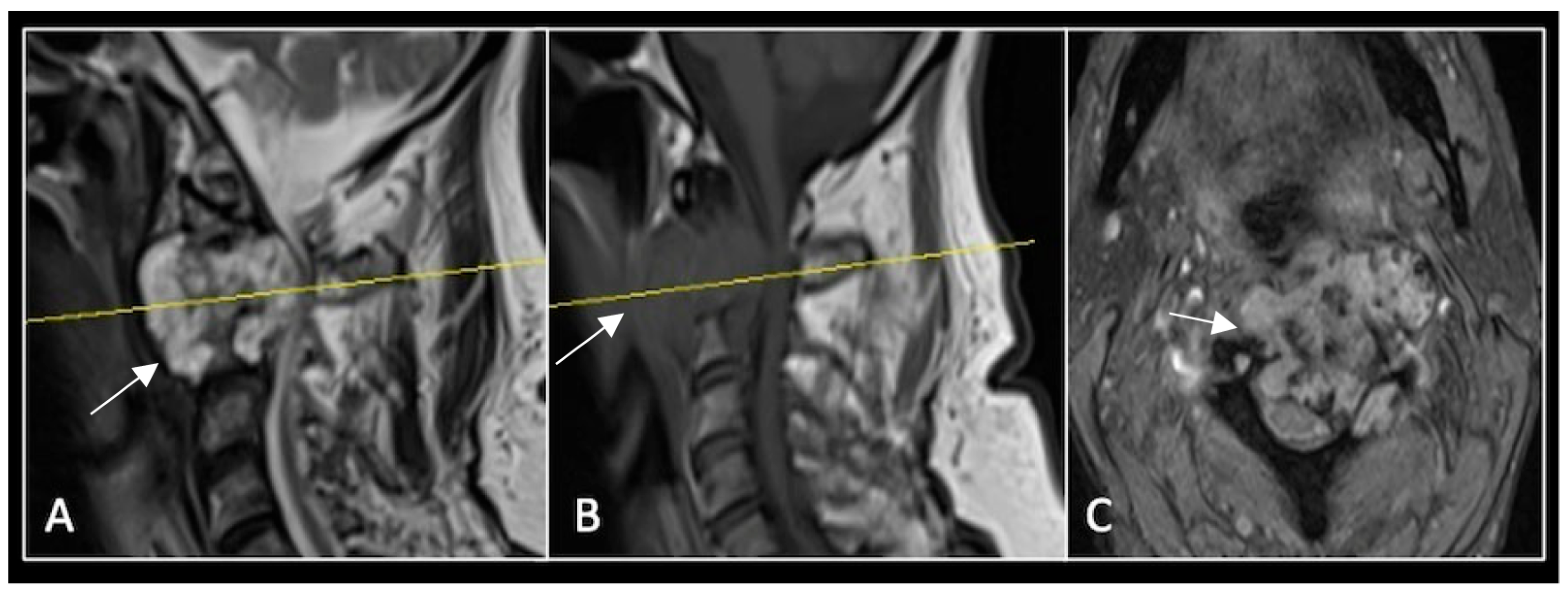 Diseases 13 00348 g002