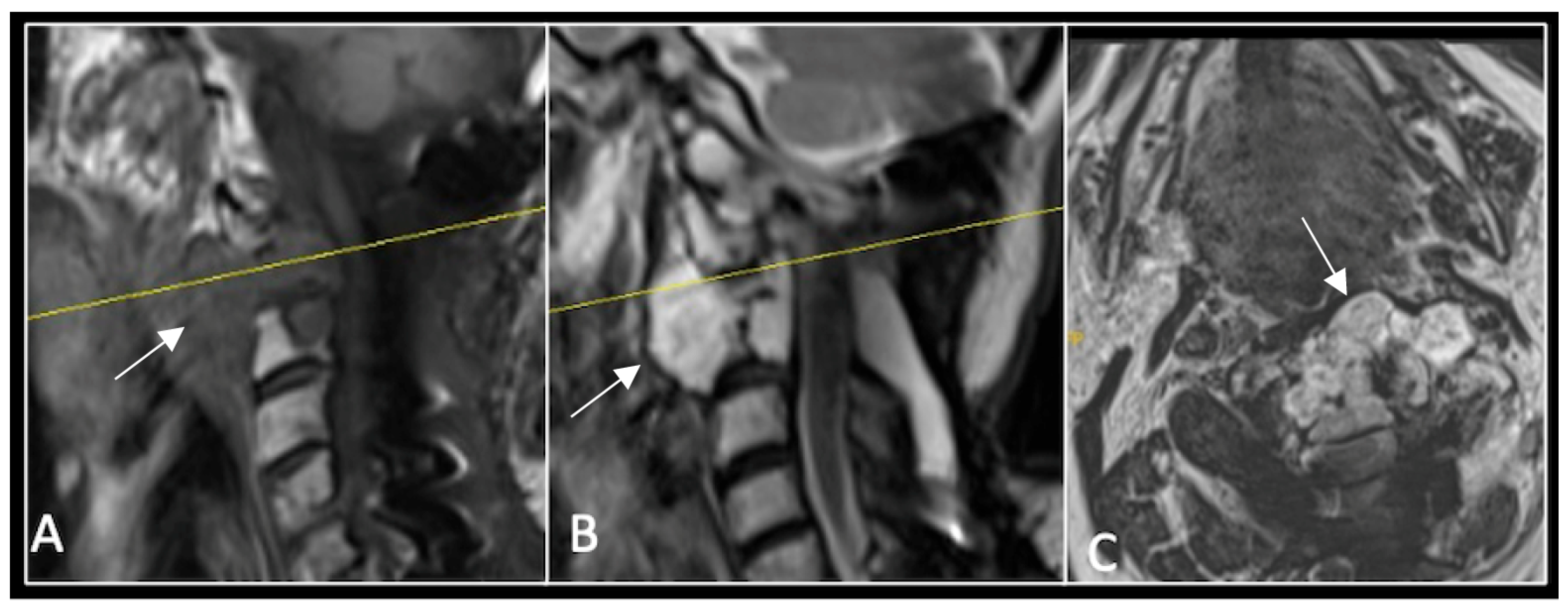 Diseases 13 00348 g003