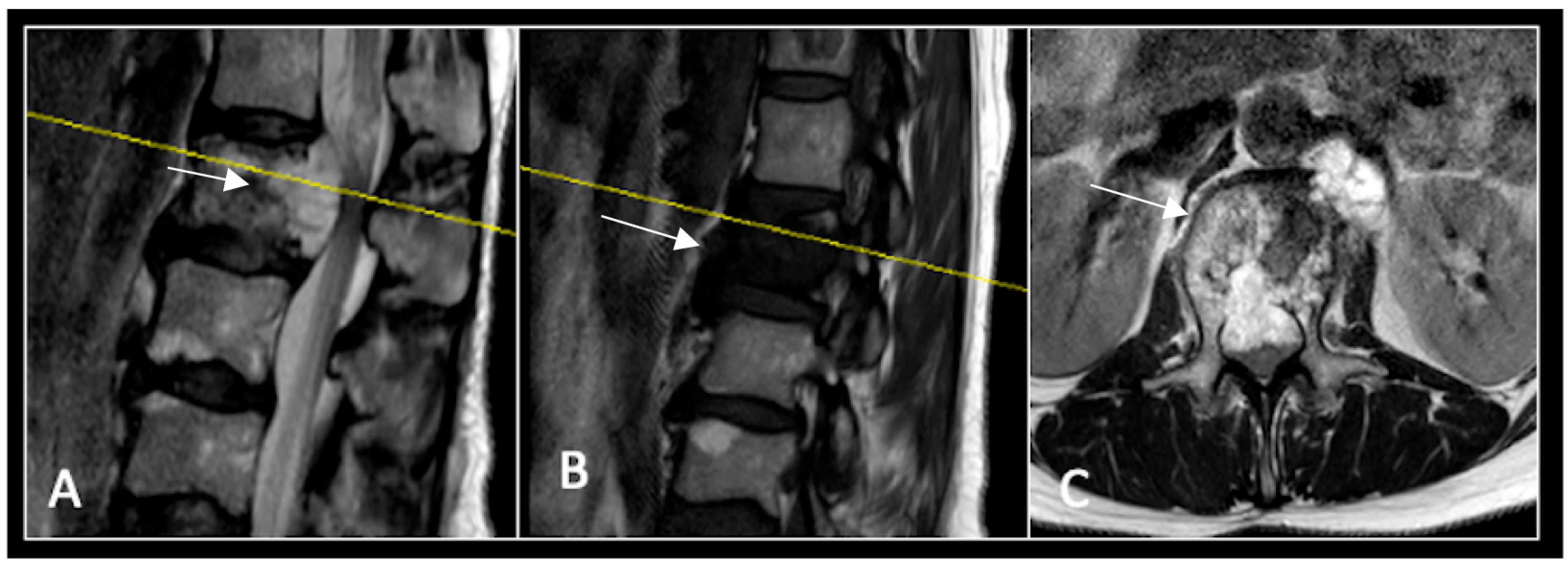 Diseases 13 00348 g011