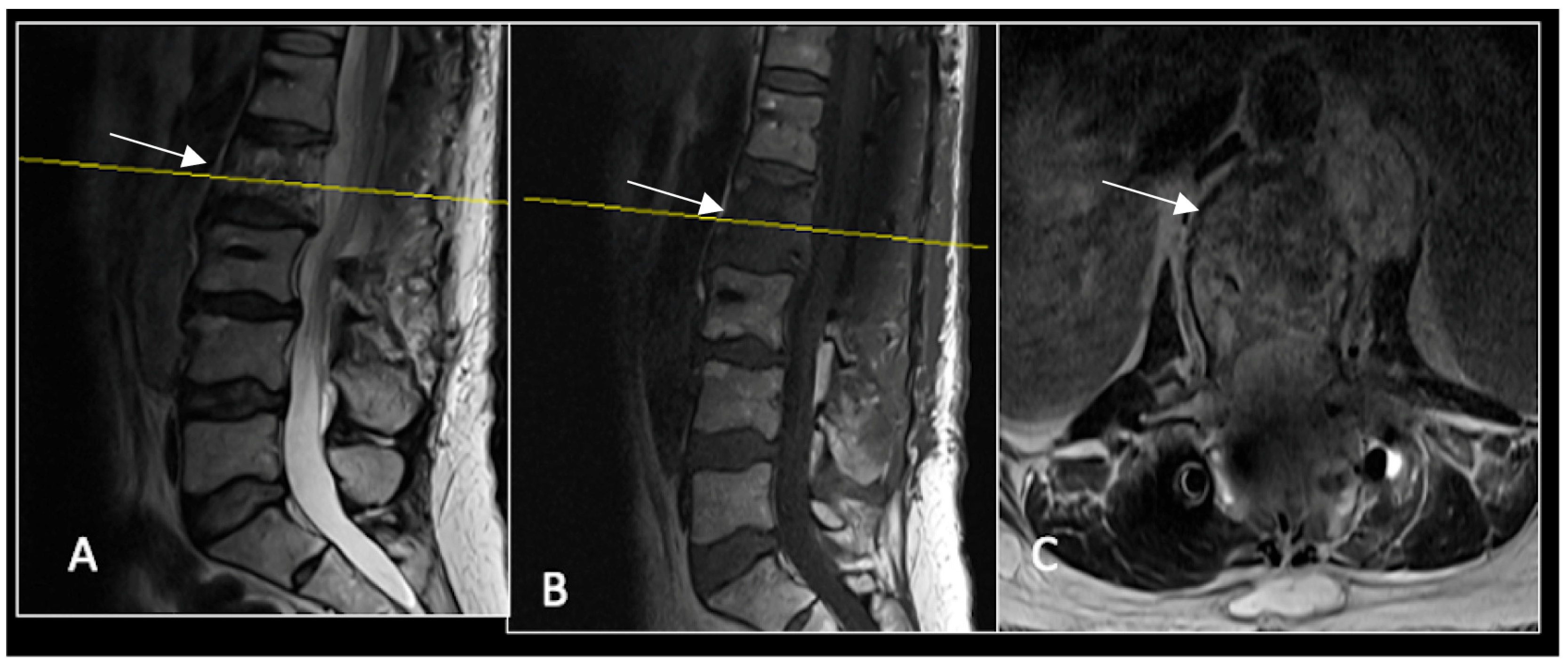 Diseases 13 00348 g013