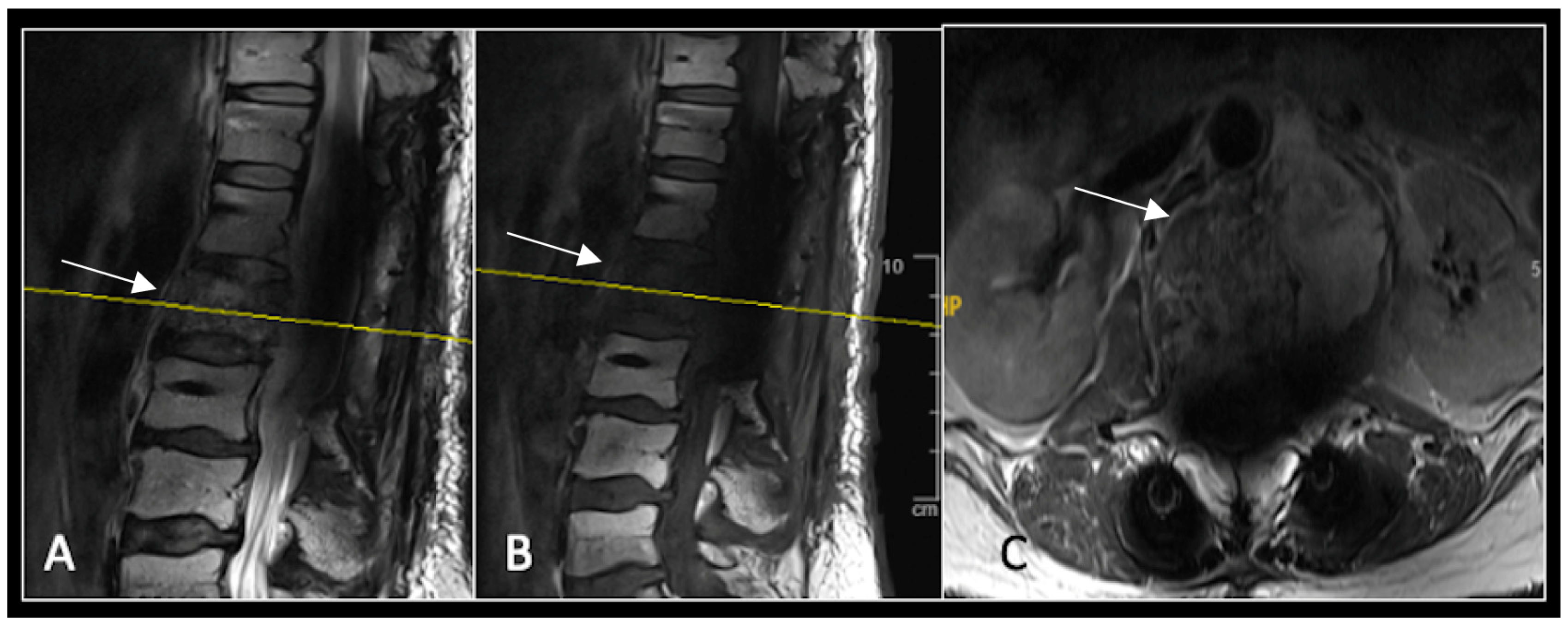 Diseases 13 00348 g014