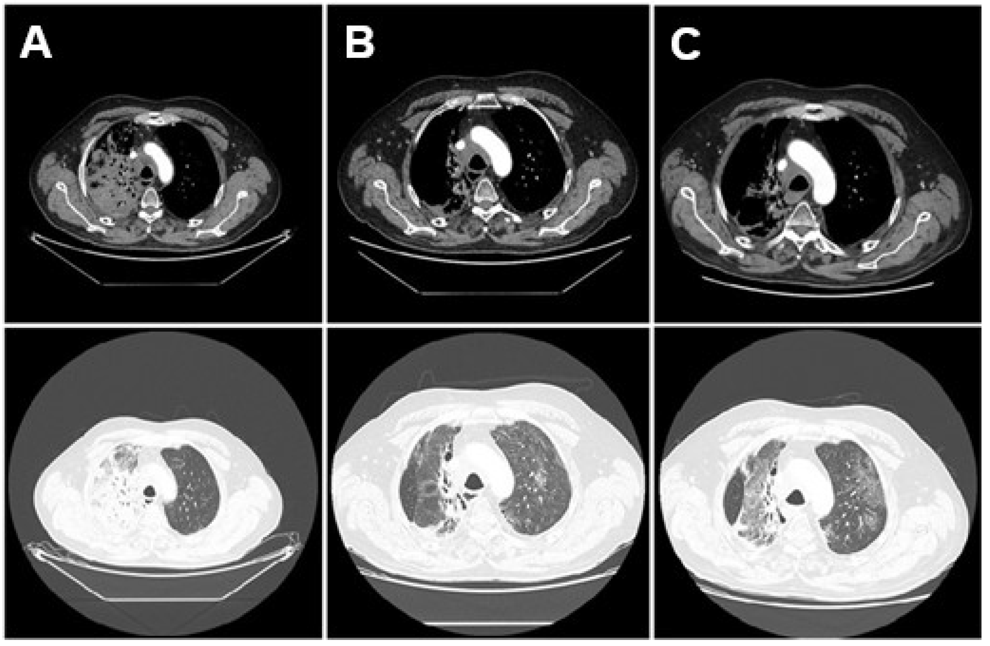 Diseases 13 00357 g002