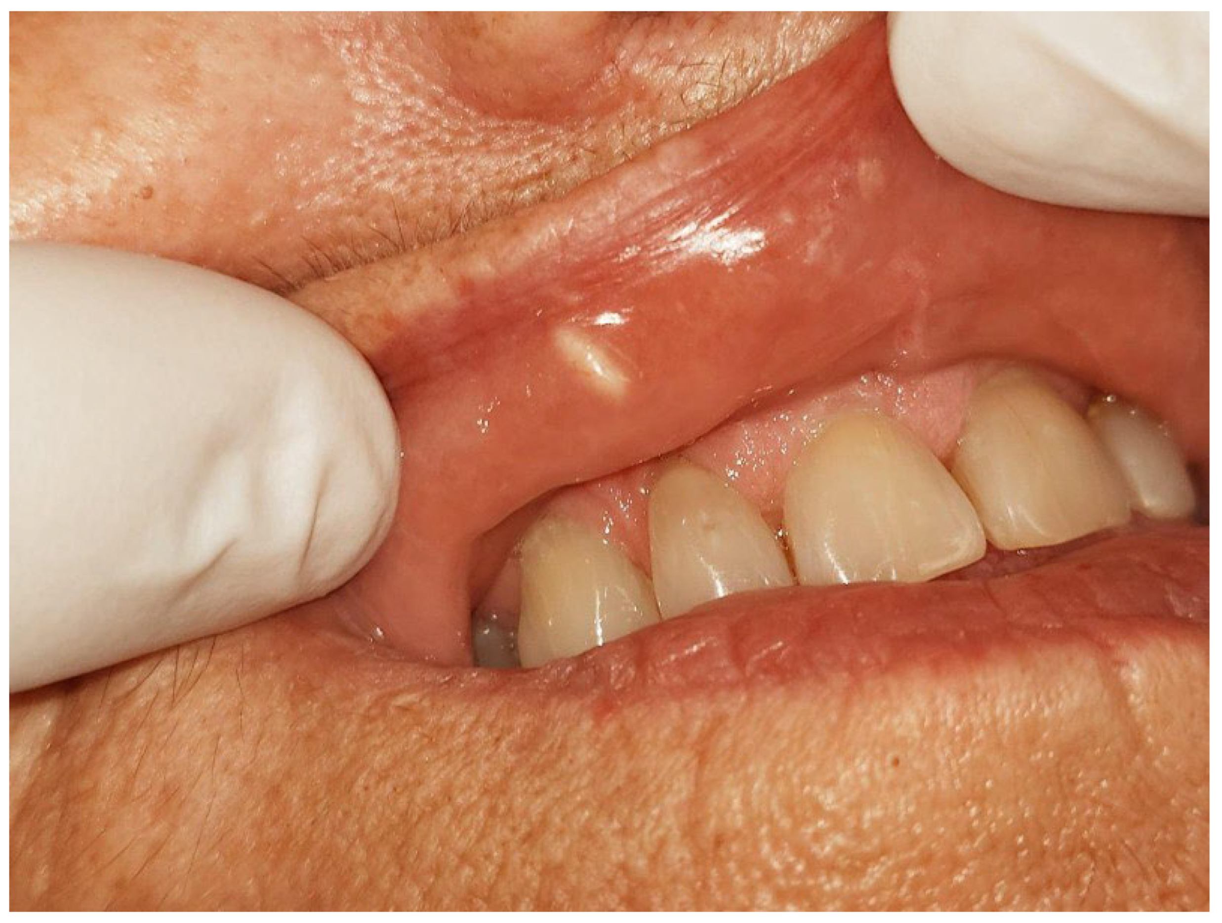 Diseases 13 00358 g001