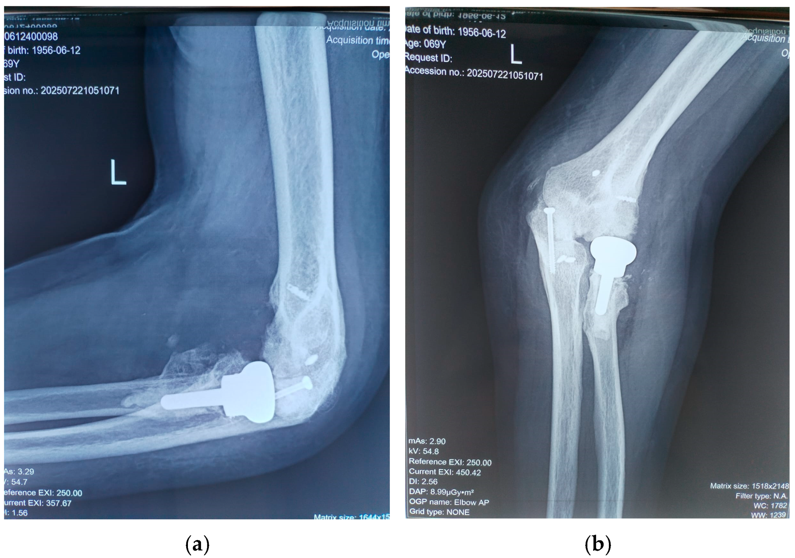 Diseases 13 00369 g005