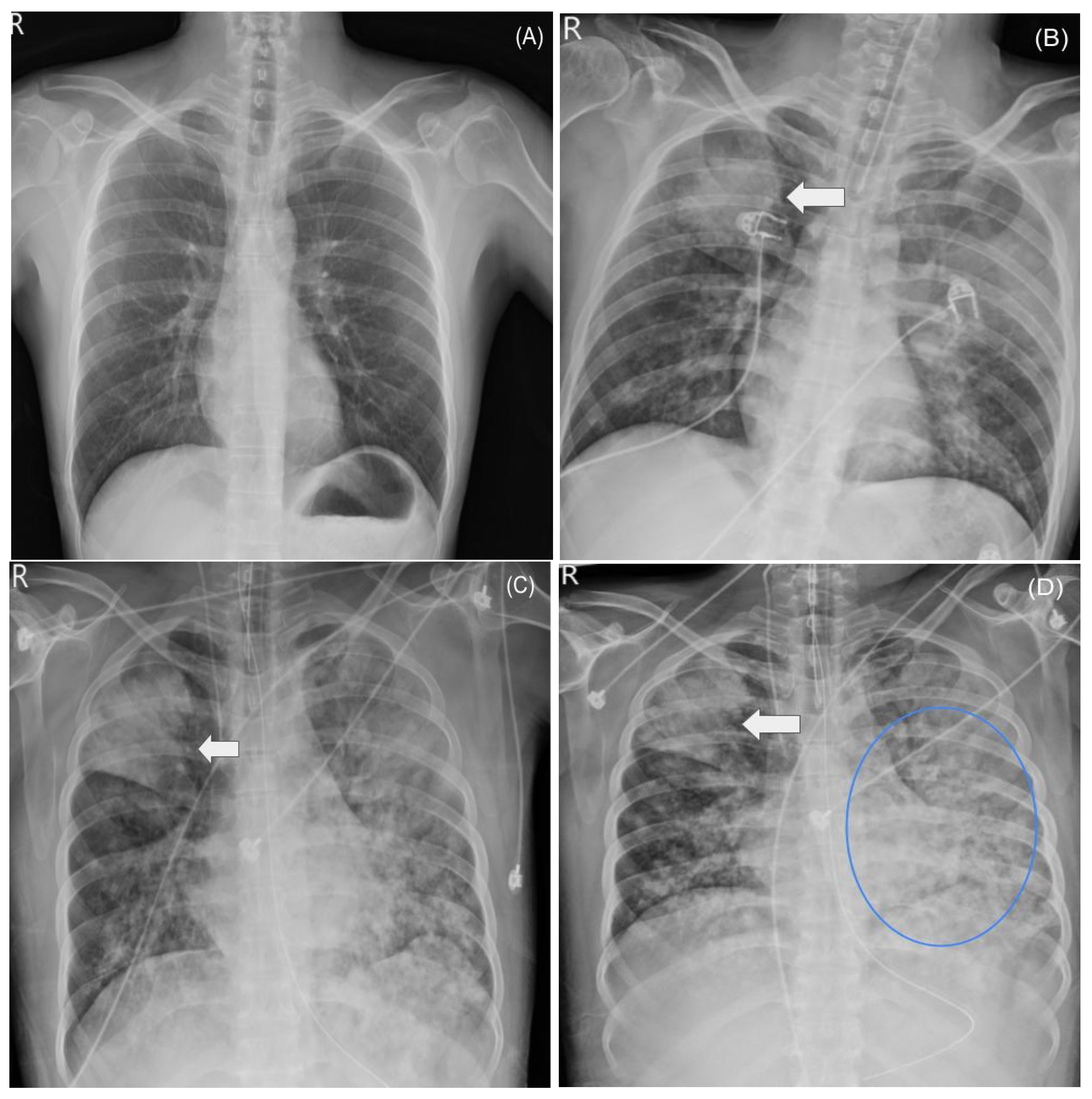 Diseases 13 00382 g002