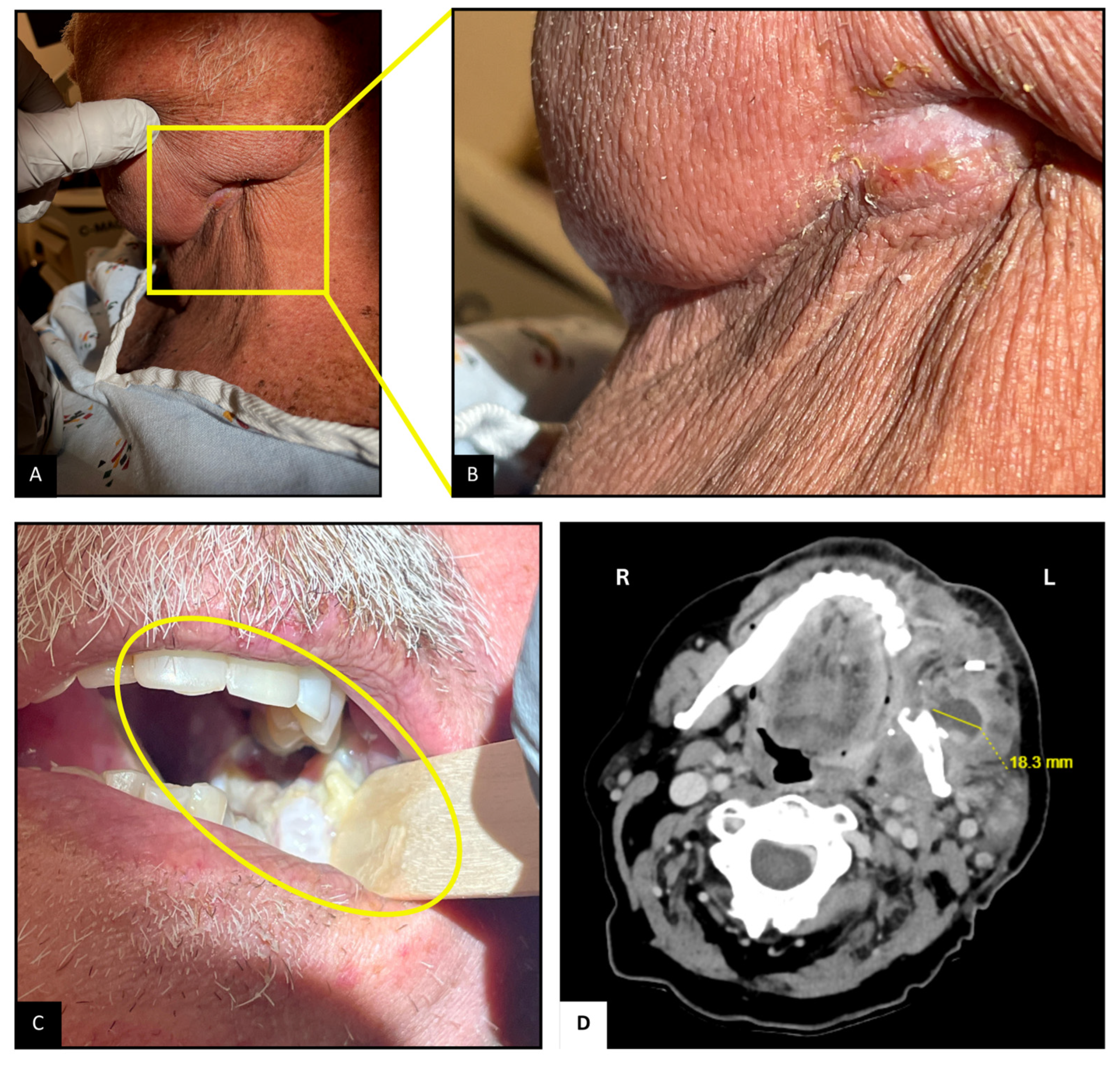 Diseases 13 00397 g001