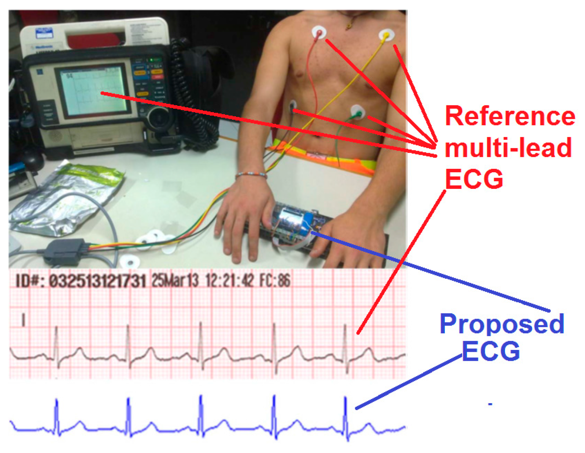 Electronics 05 00047 g011