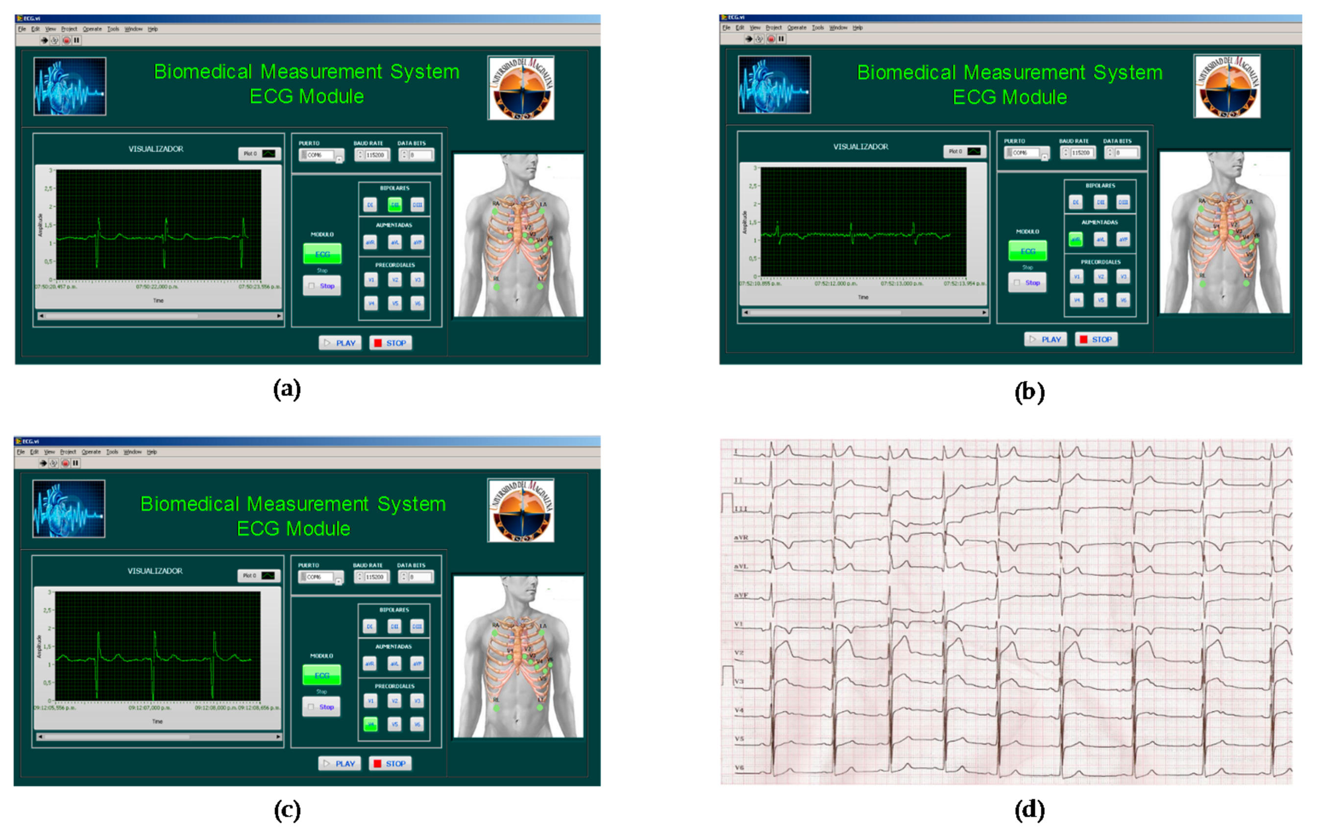 Electronics 07 00077 g023