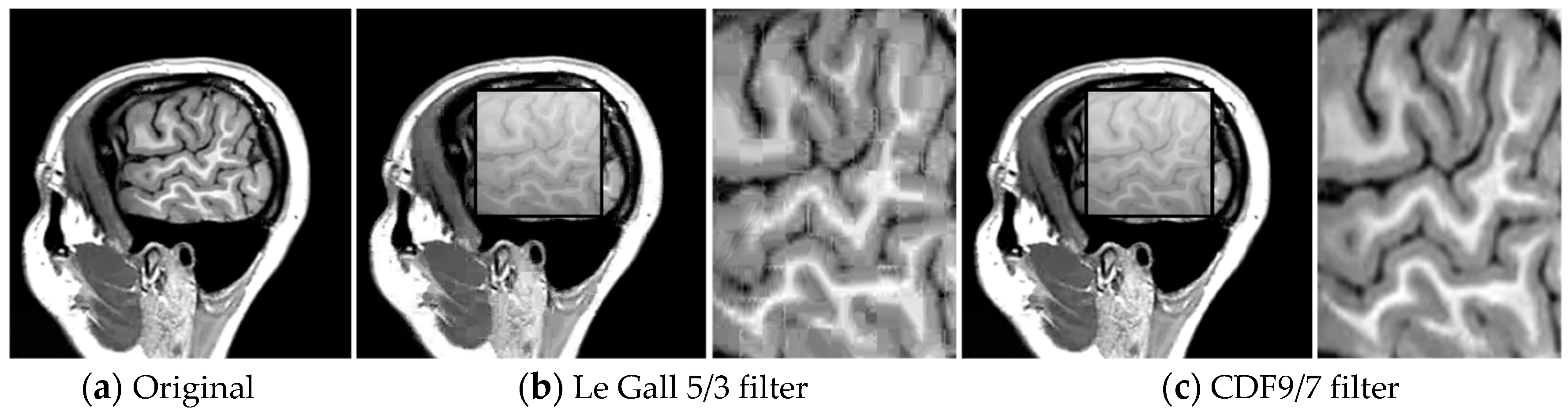 Electronics 08 00088 g008 Electronics 08 00088 g008